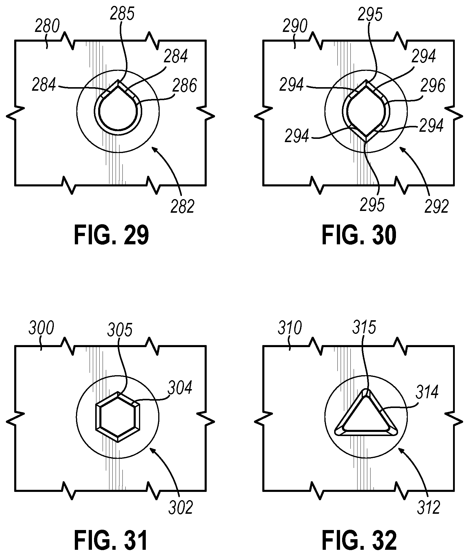 Patent US12310593 Figure 16 – Implantable sphincter device with bead orientation control based on bead interactive geometry