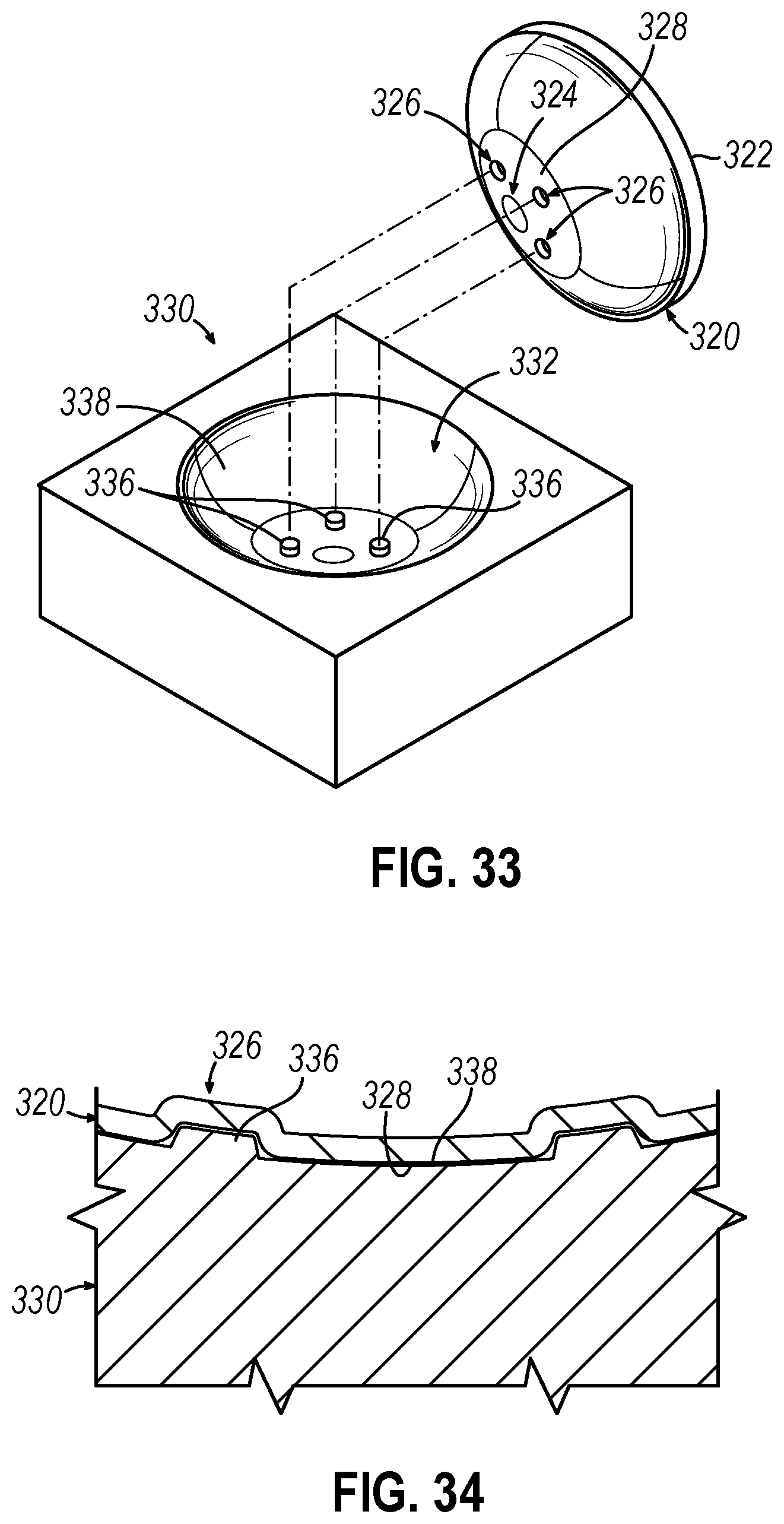 Patent US12310593 Figure 17 – Implantable sphincter device with bead orientation control based on bead interactive geometry