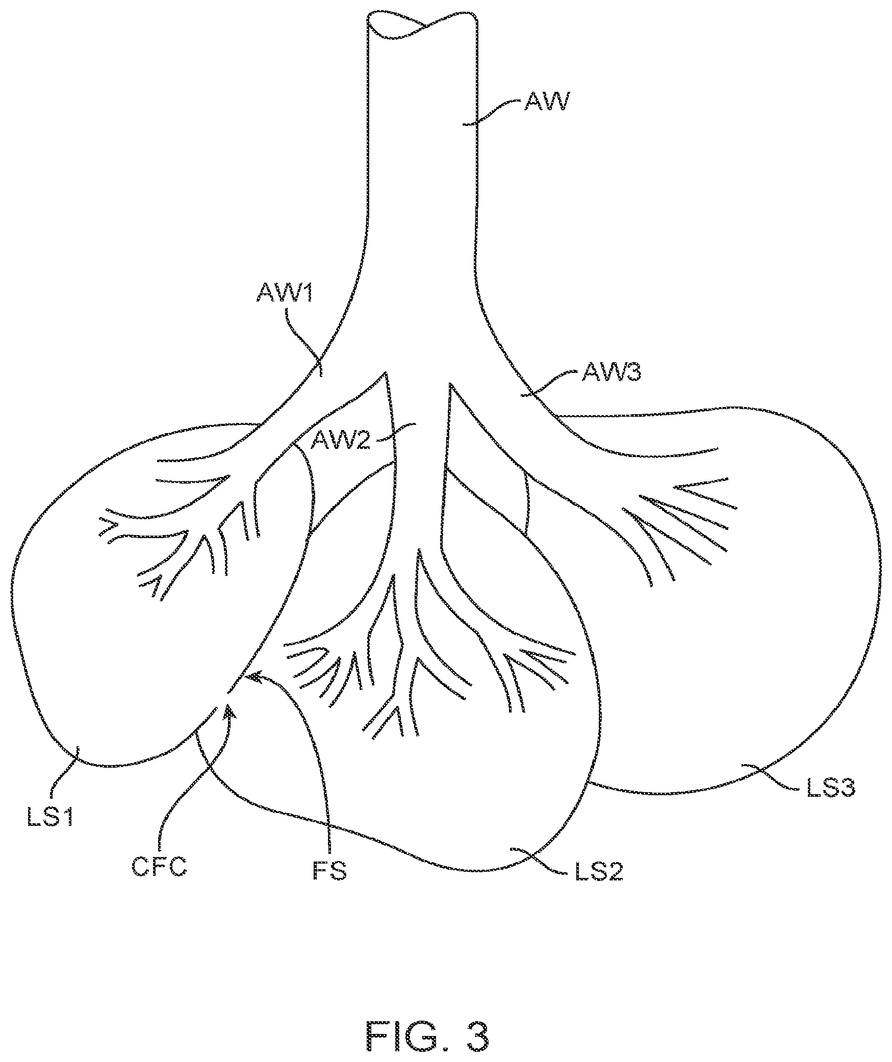 Patent US12310594 Figure 3 – Collateral flow channel sealant delivery methods and systems