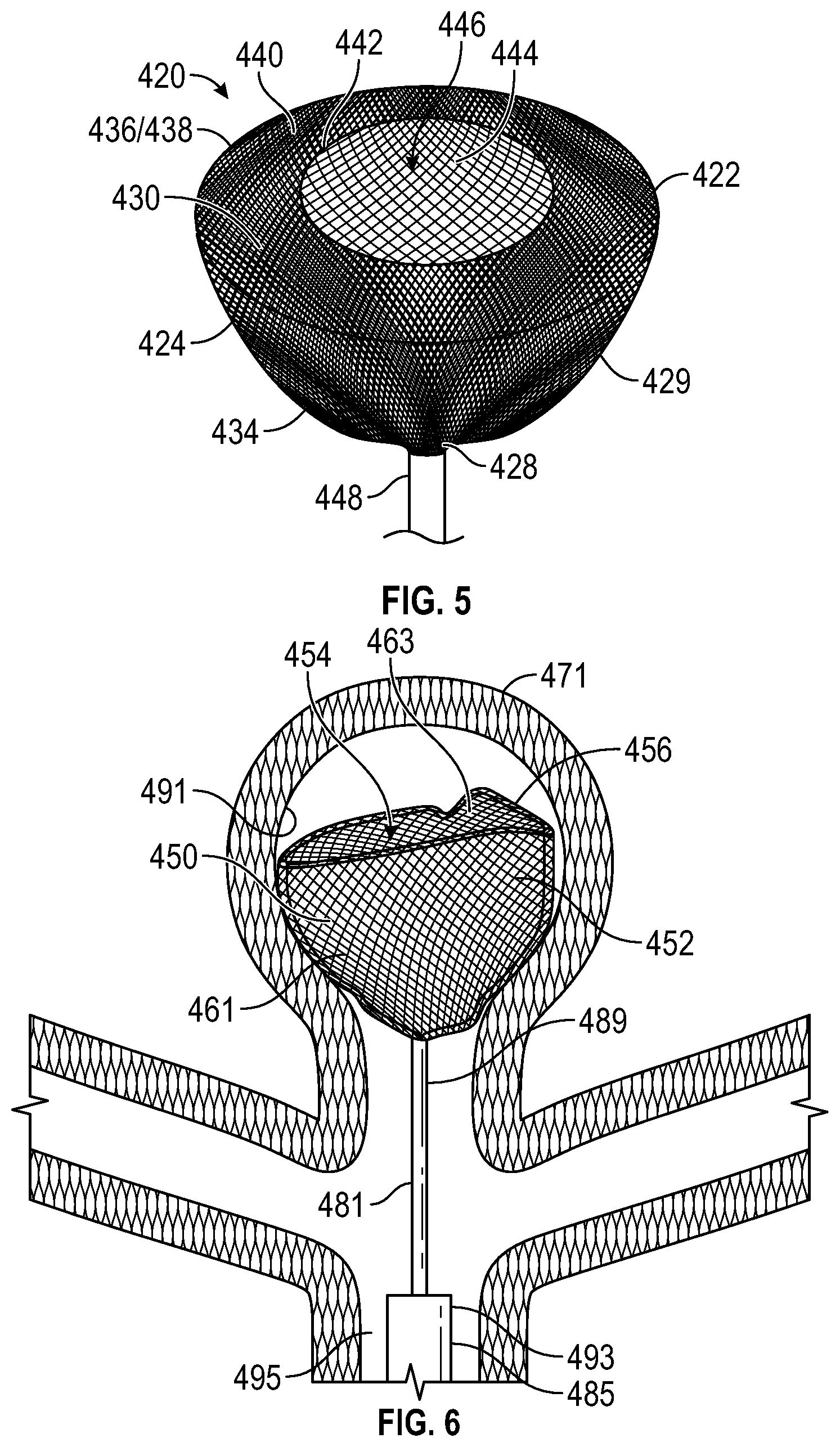 Patent US12310595 Figure 2 – Systems and methods for treating aneurysms