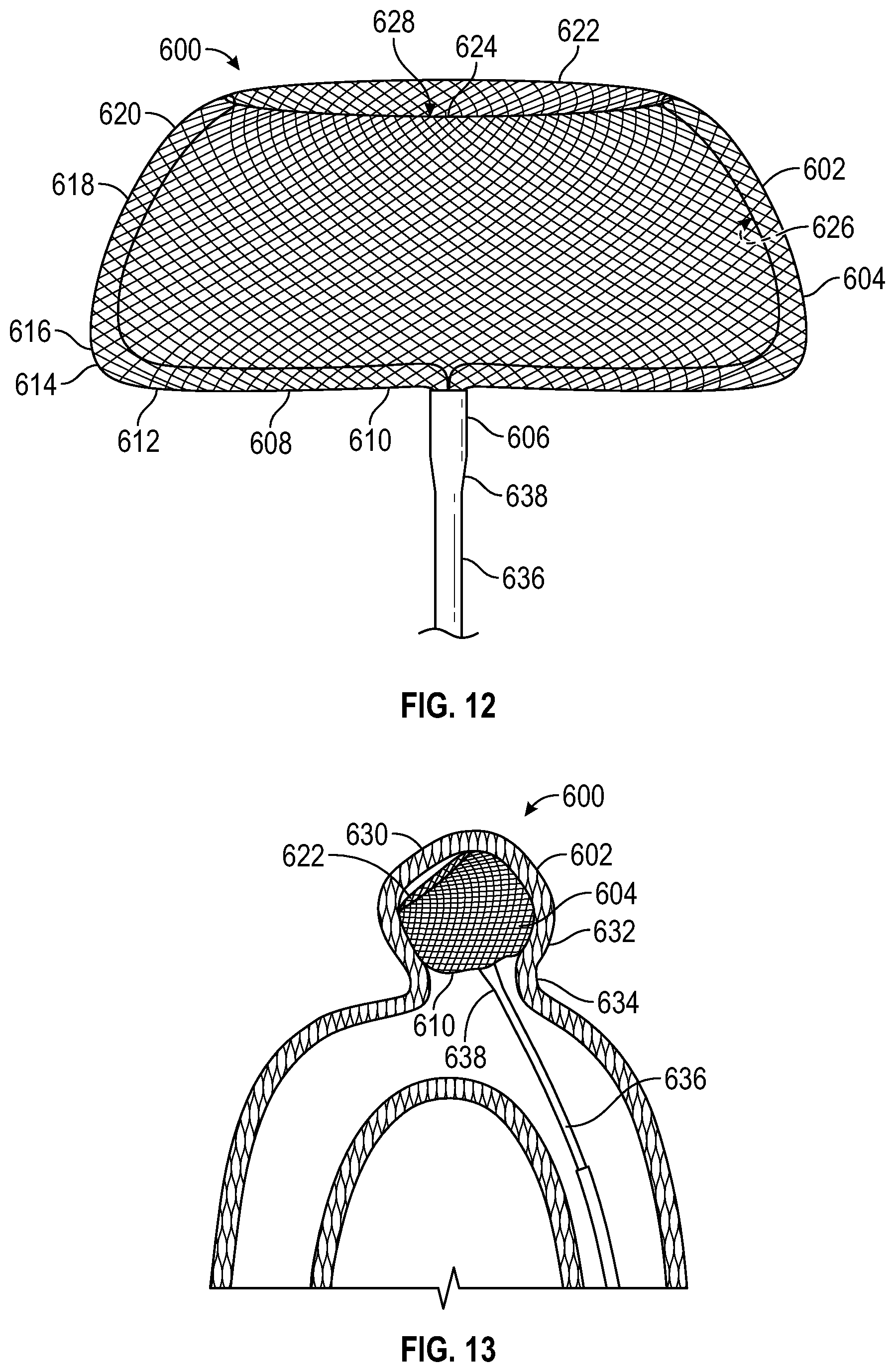 Patent US12310595 Figure 6 – Systems and methods for treating aneurysms