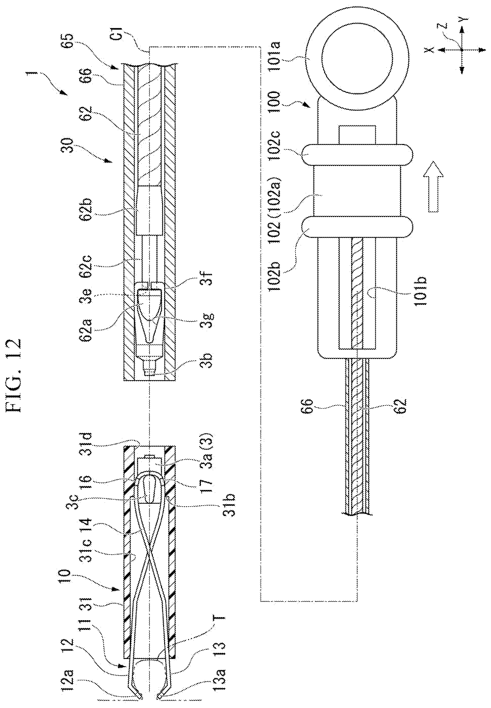 Patent US12310597 Figure 11 – Clip cartridge, medical device, and attachment method for medical device