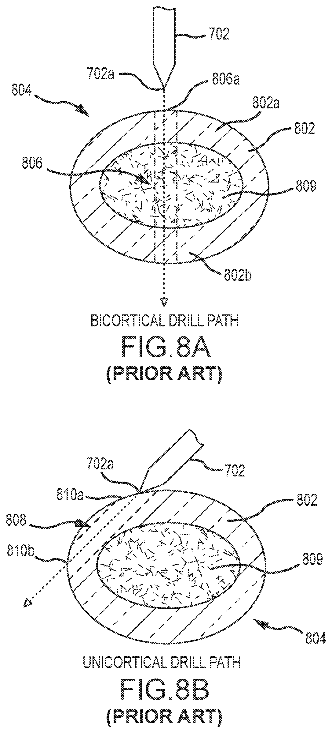 Patent US12310600 Figure 8 – Drill bit data management for penetration-monitoring drill