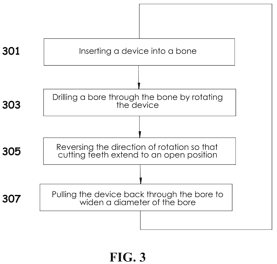 Patent US12310601 Figure 4 – Kit including a guiding system and a bone material removal device