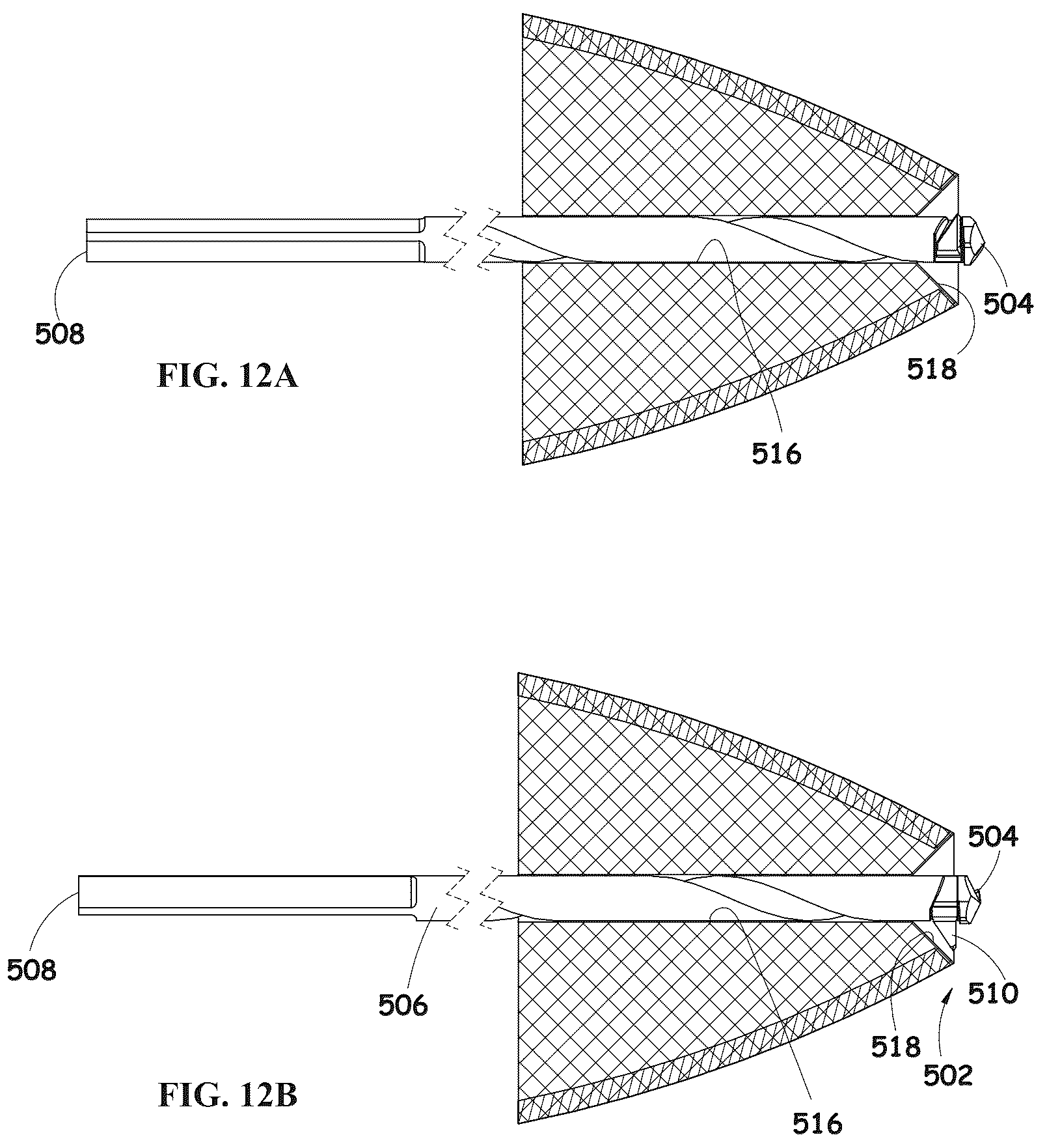Patent US12310601 Figure 13 – Kit including a guiding system and a bone material removal device