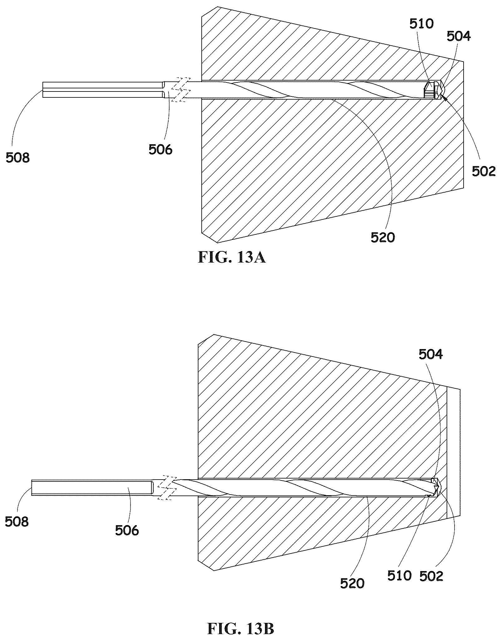Patent US12310601 Figure 14 – Kit including a guiding system and a bone material removal device