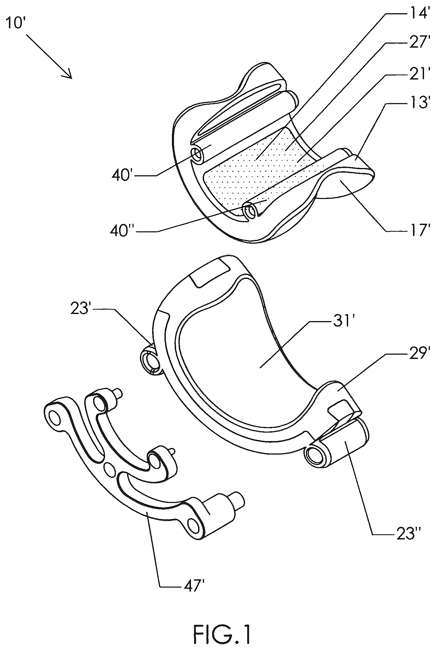 Patent US12310602 Figure 1 – Milling apparatus for implanting a joint prosthesis