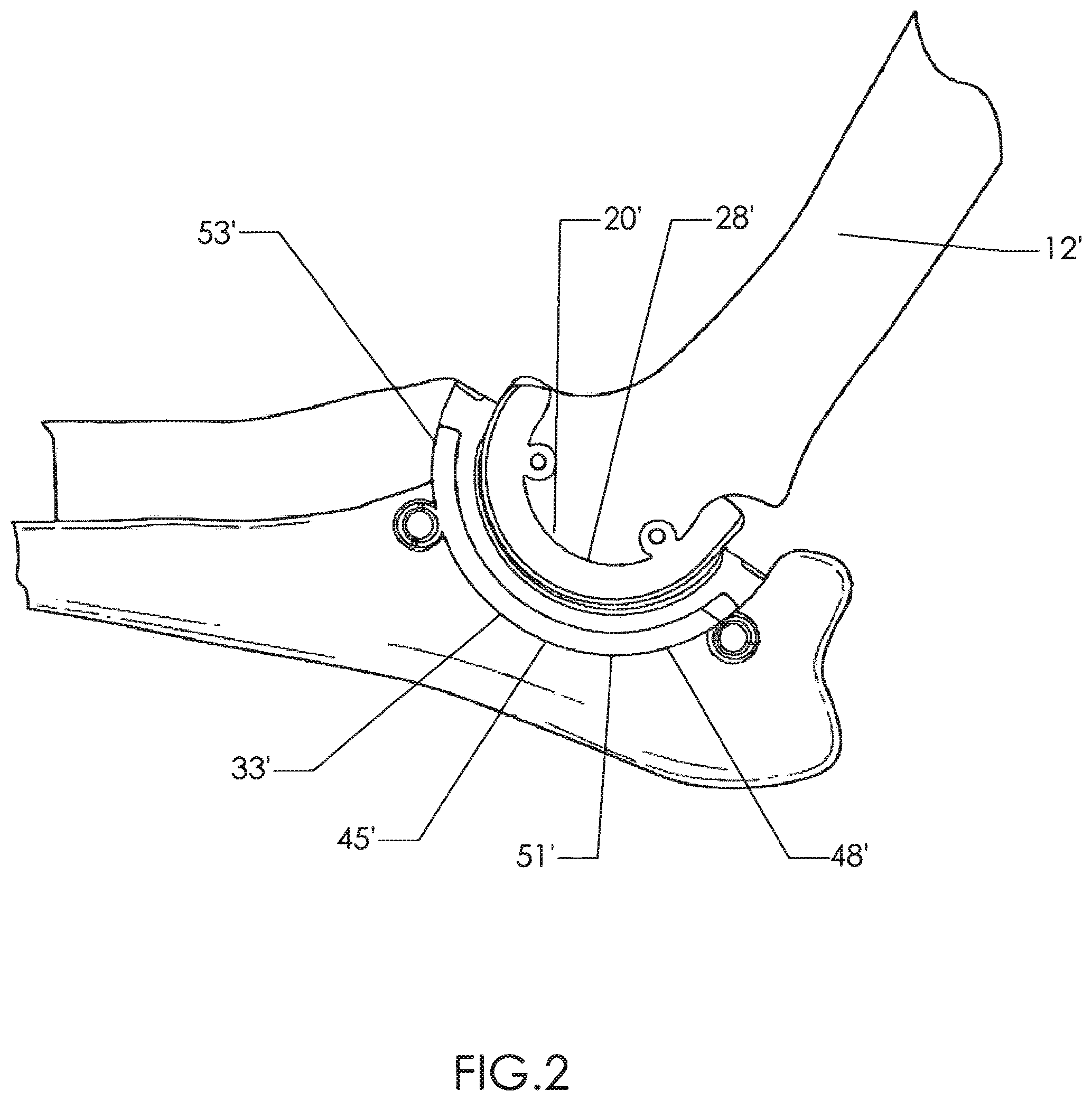 Patent US12310602 Figure 2 – Milling apparatus for implanting a joint prosthesis