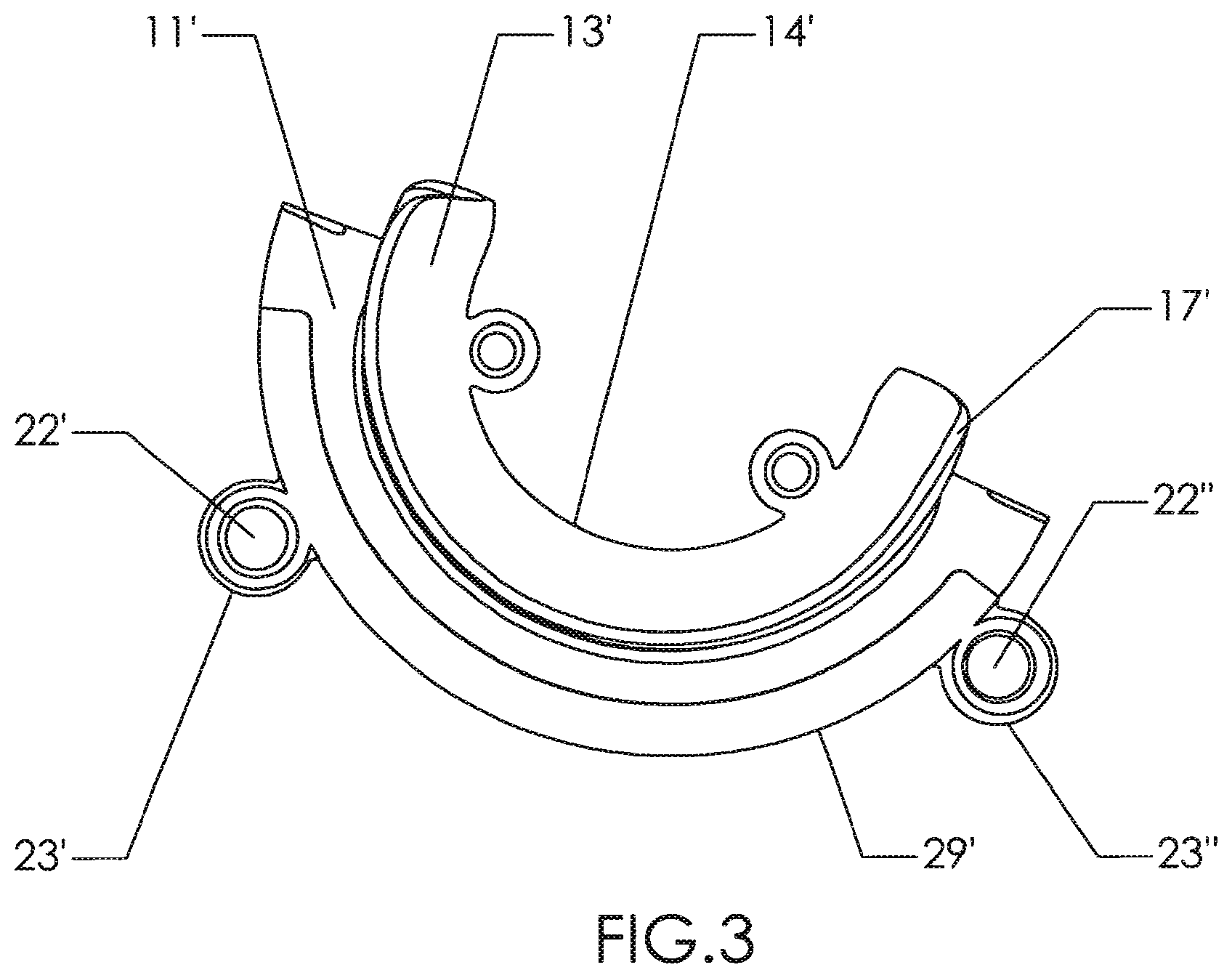 Patent US12310602 Figure 3 – Milling apparatus for implanting a joint prosthesis