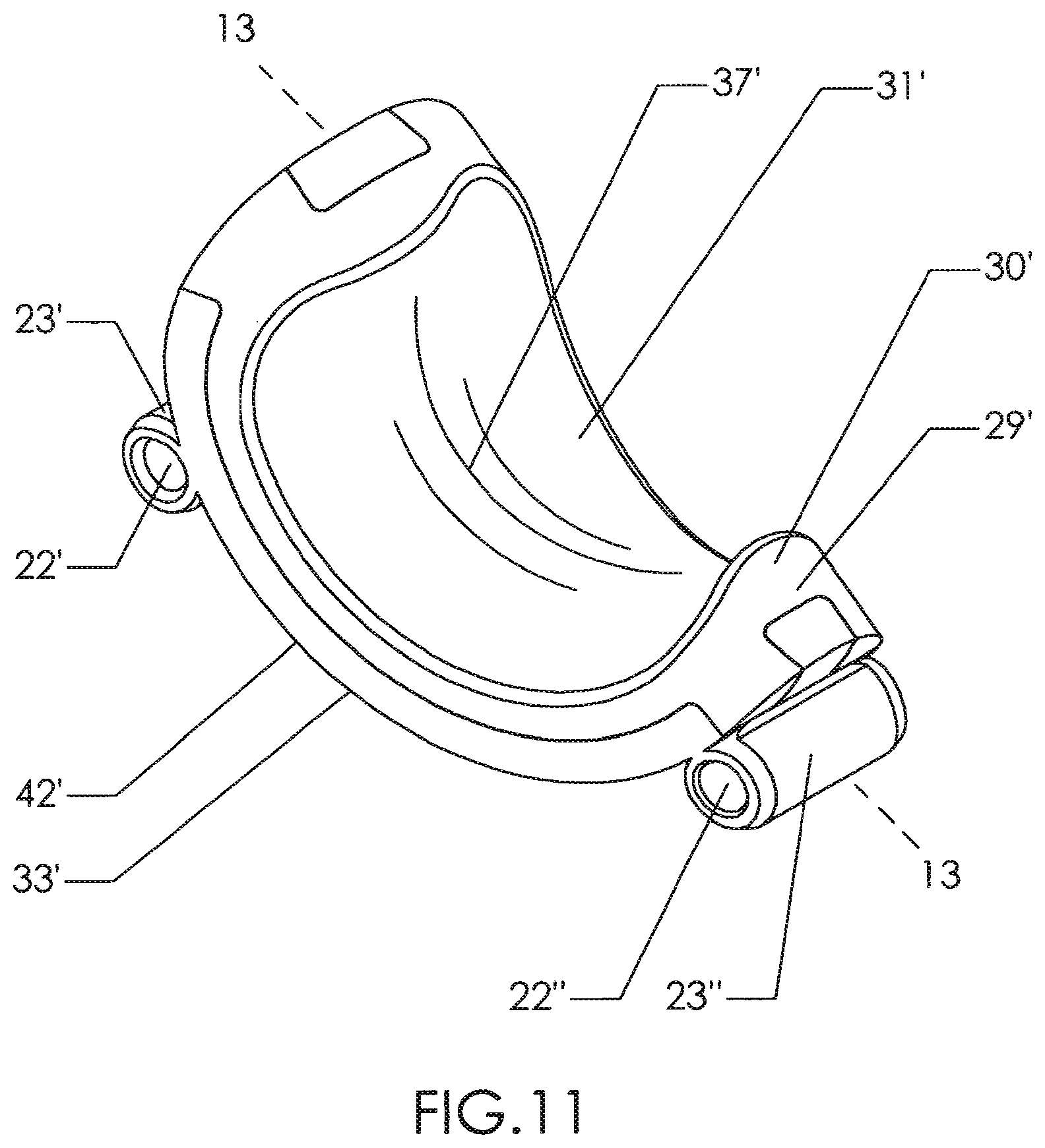 Patent US12310602 Figure 9 – Milling apparatus for implanting a joint prosthesis