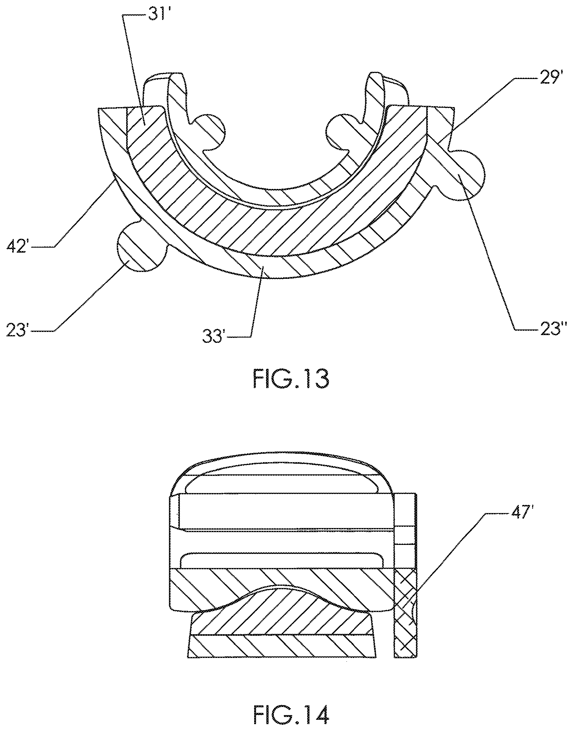 Patent US12310602 Figure 11 – Milling apparatus for implanting a joint prosthesis
