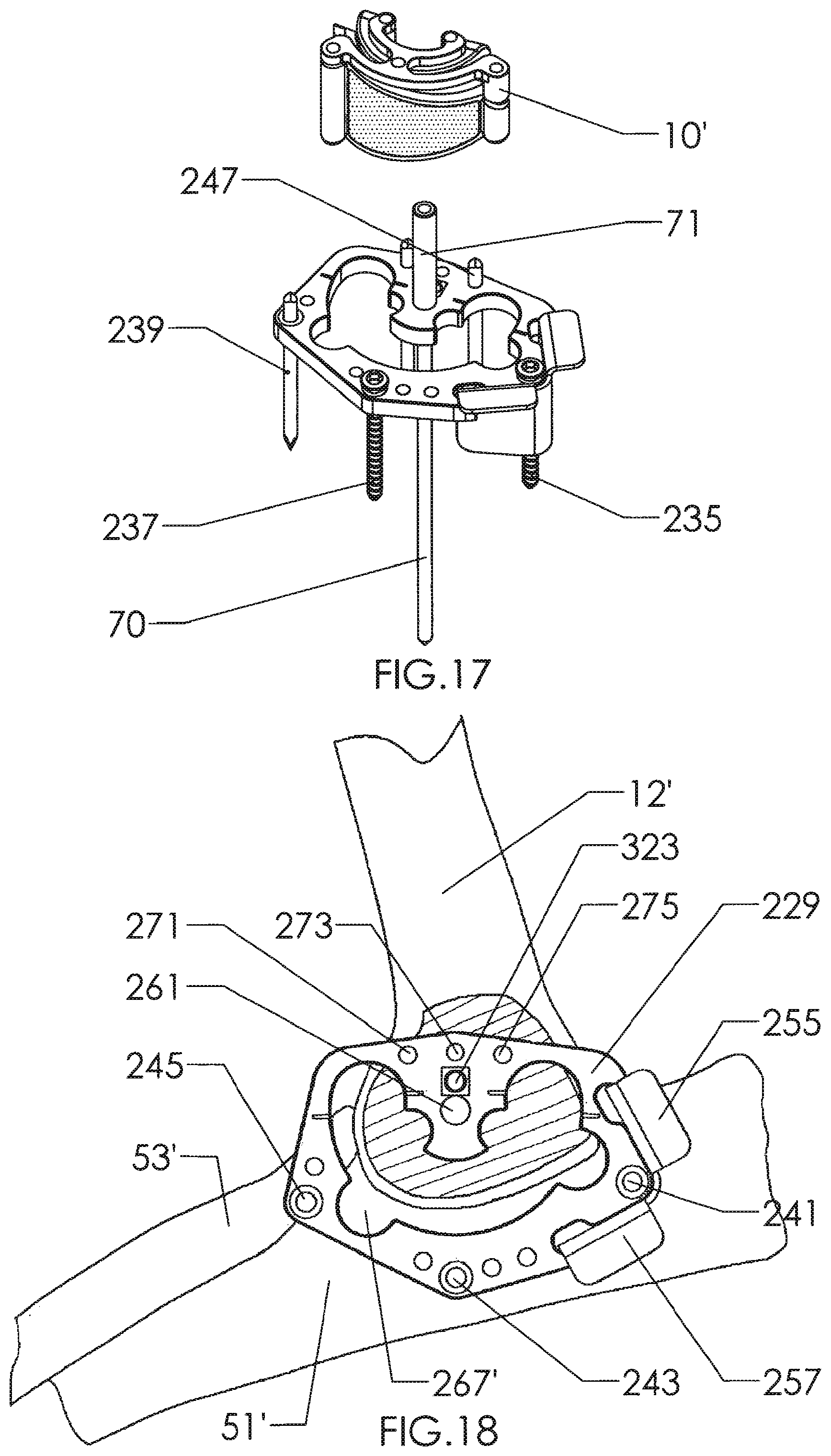 Patent US12310602 Figure 14 – Milling apparatus for implanting a joint prosthesis