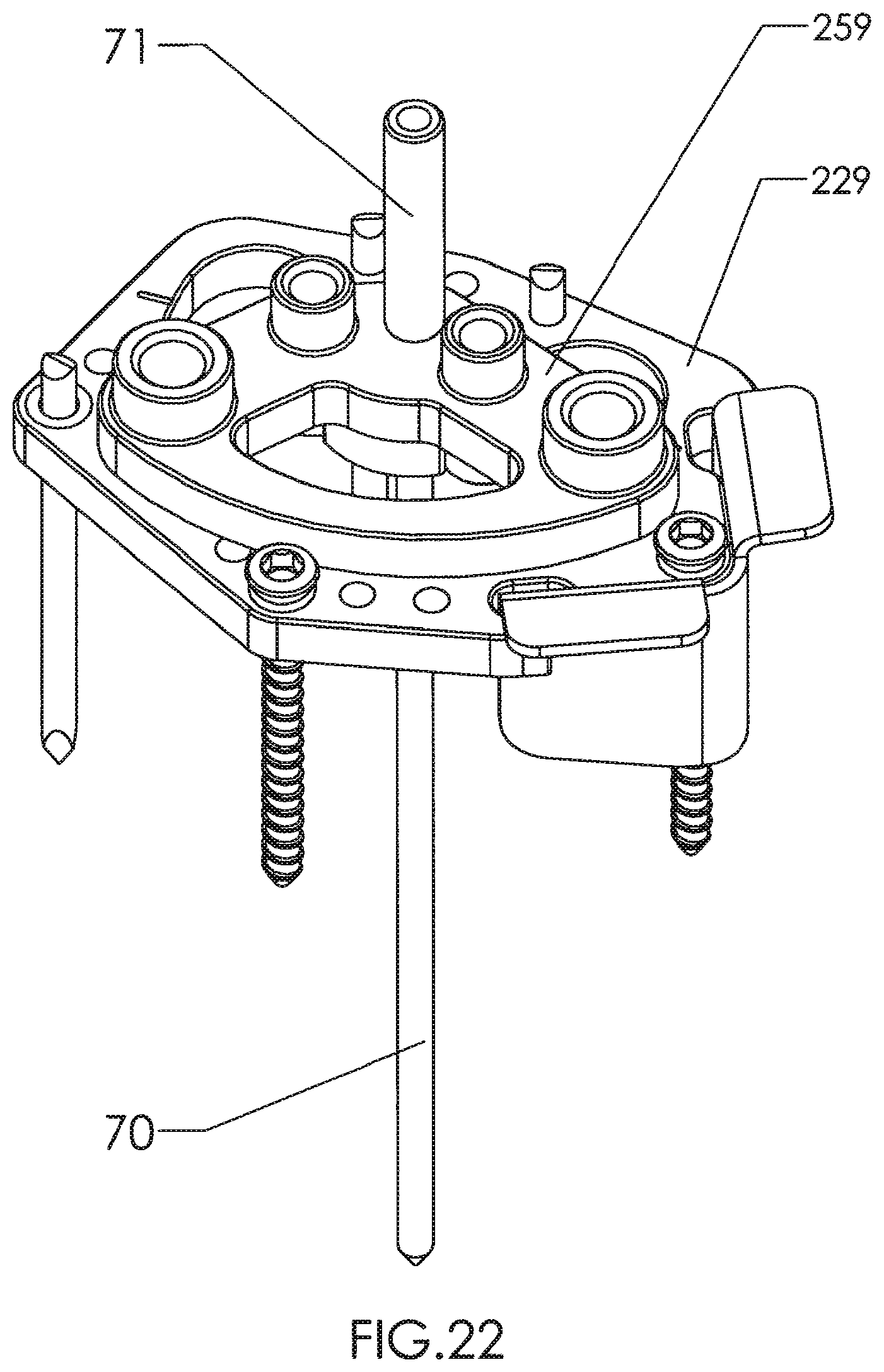 Patent US12310602 Figure 16 – Milling apparatus for implanting a joint prosthesis