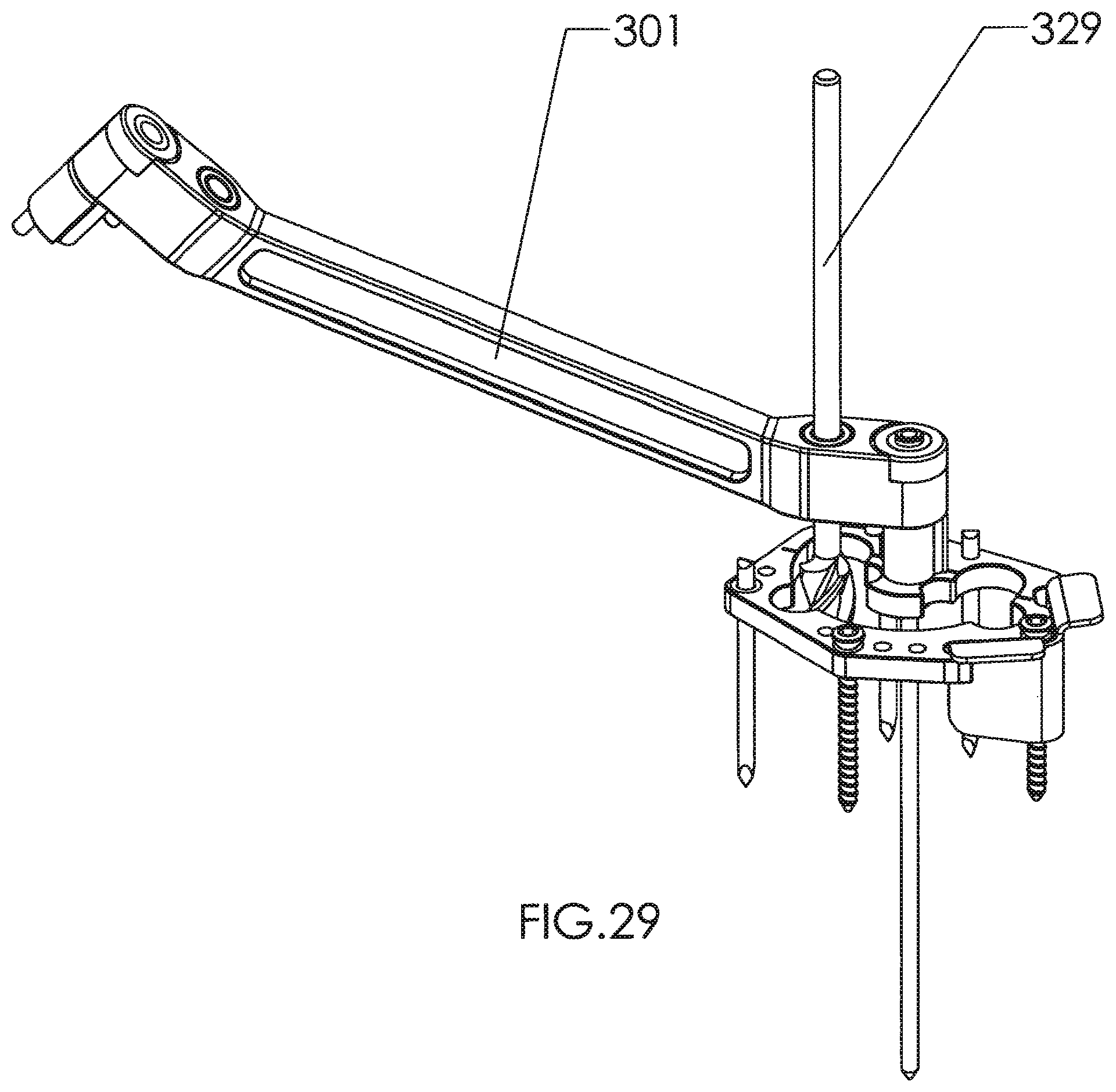 Patent US12310602 Figure 20 – Milling apparatus for implanting a joint prosthesis