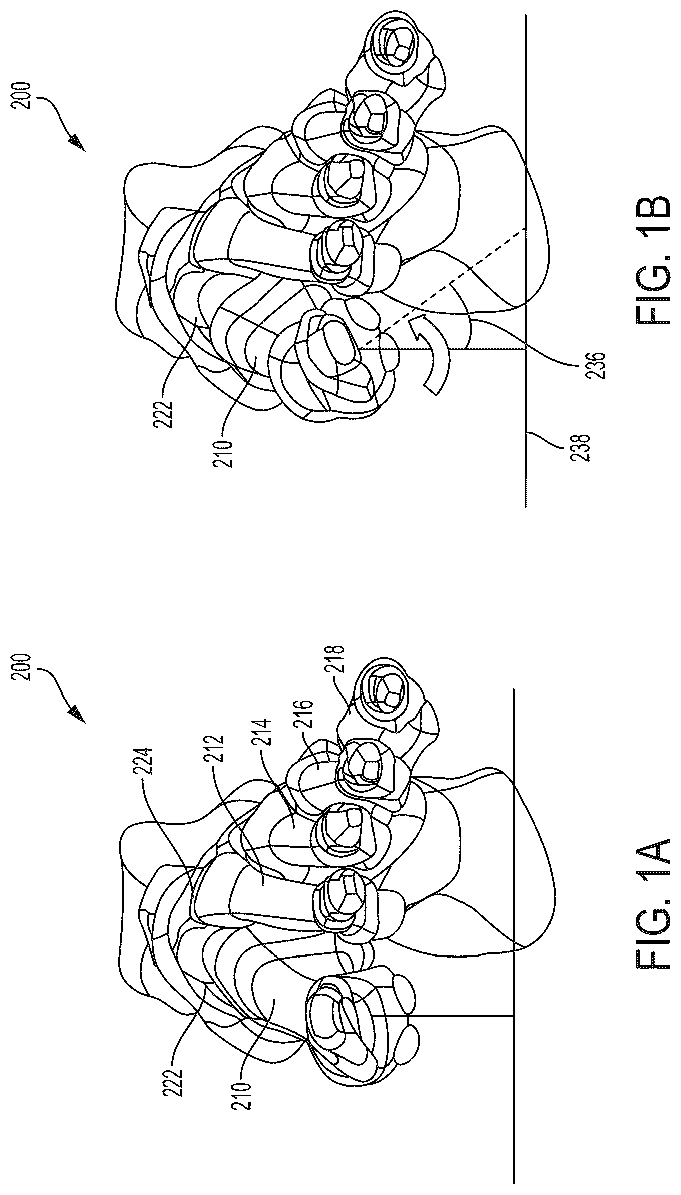 Patent US12310603 Figure 1 – System and technique for metatarsal realignment with reduced incision length