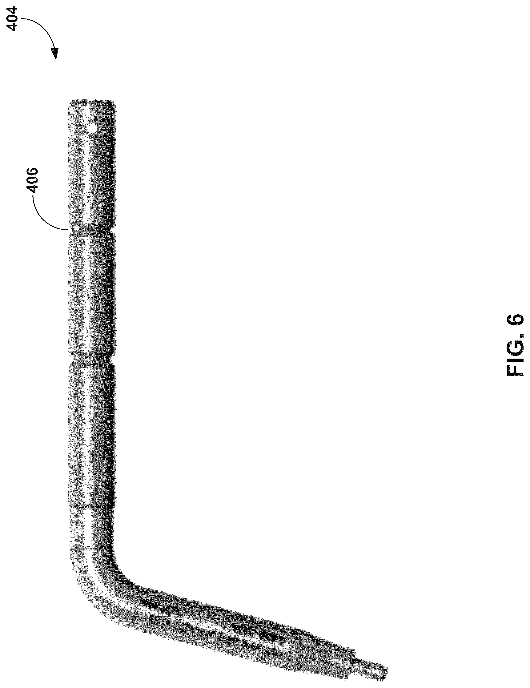 Patent US12310603 Figure 6 – System and technique for metatarsal realignment with reduced incision length