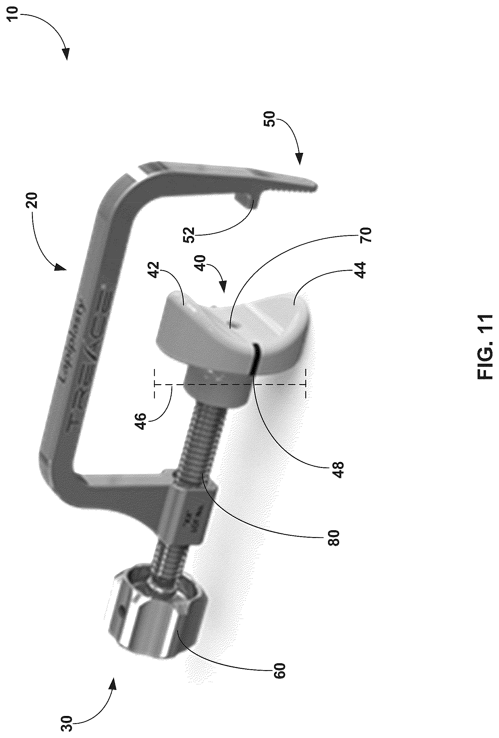 Patent US12310603 Figure 11 – System and technique for metatarsal realignment with reduced incision length