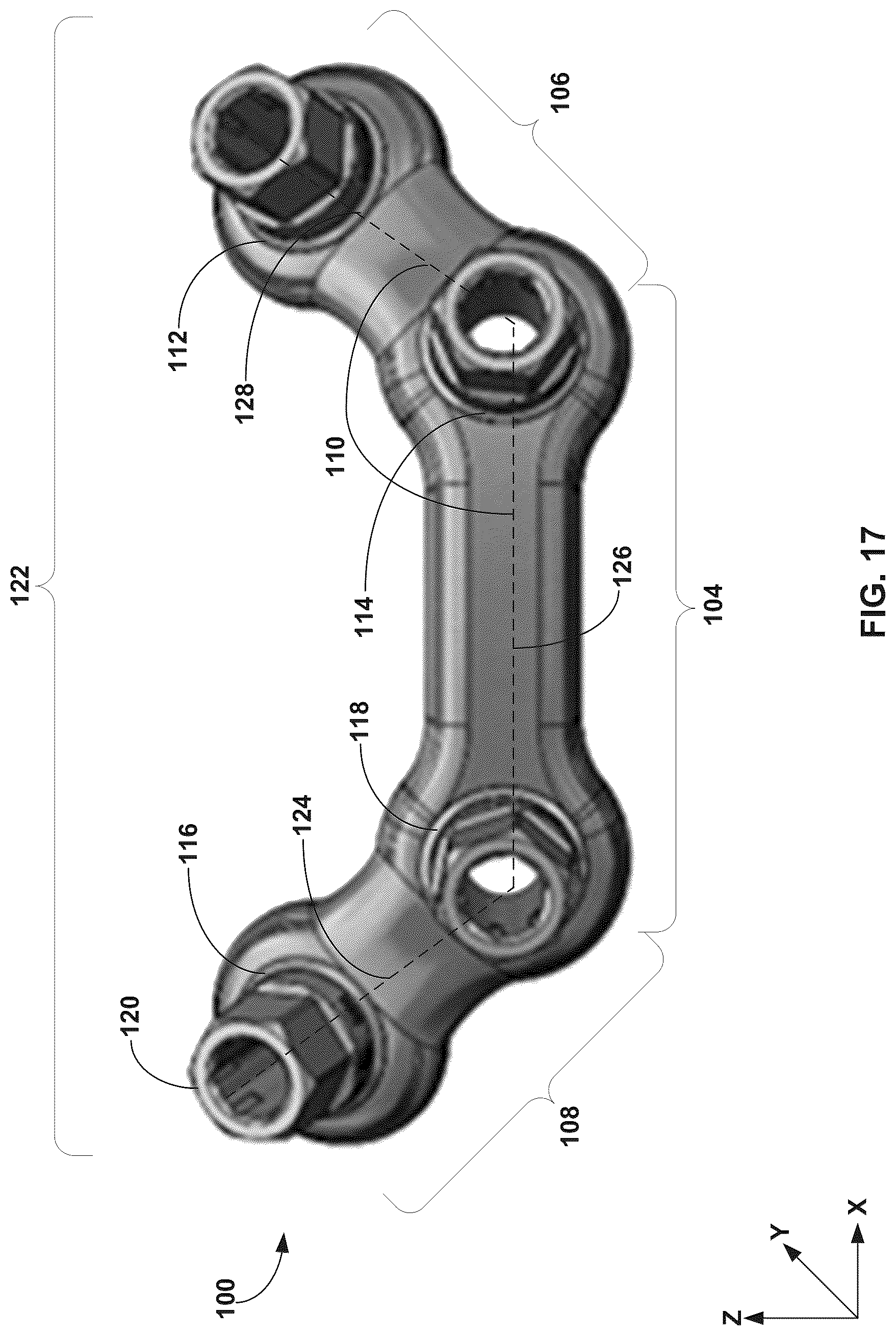 Patent US12310603 Figure 17 – System and technique for metatarsal realignment with reduced incision length