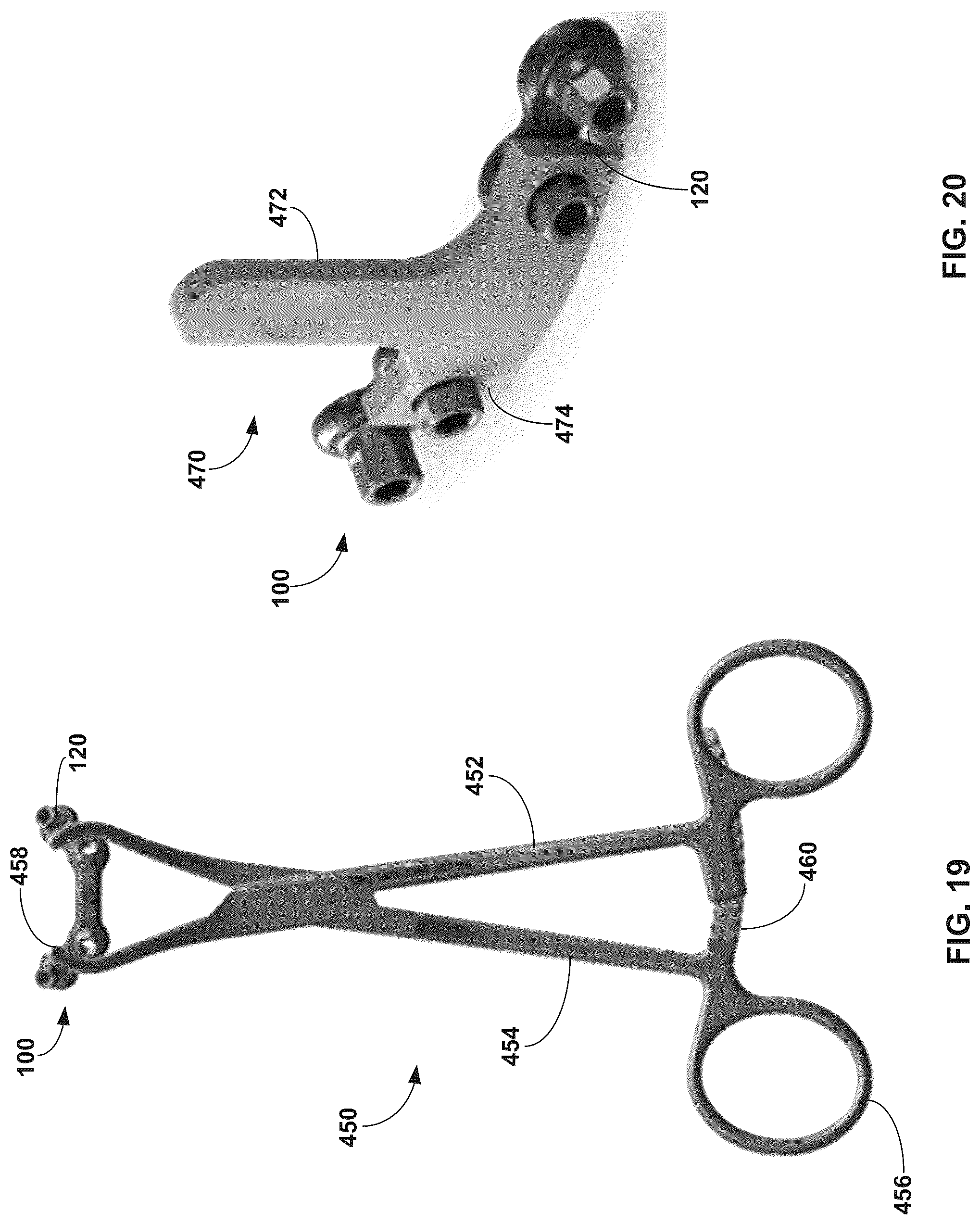 Patent US12310603 Figure 19 – System and technique for metatarsal realignment with reduced incision length