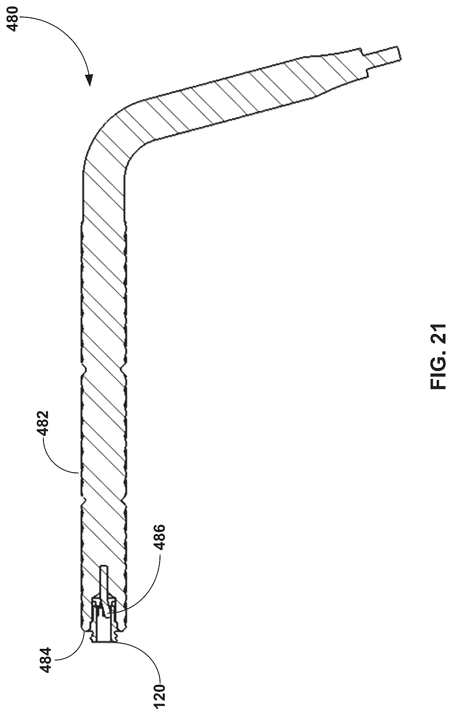 Patent US12310603 Figure 20 – System and technique for metatarsal realignment with reduced incision length