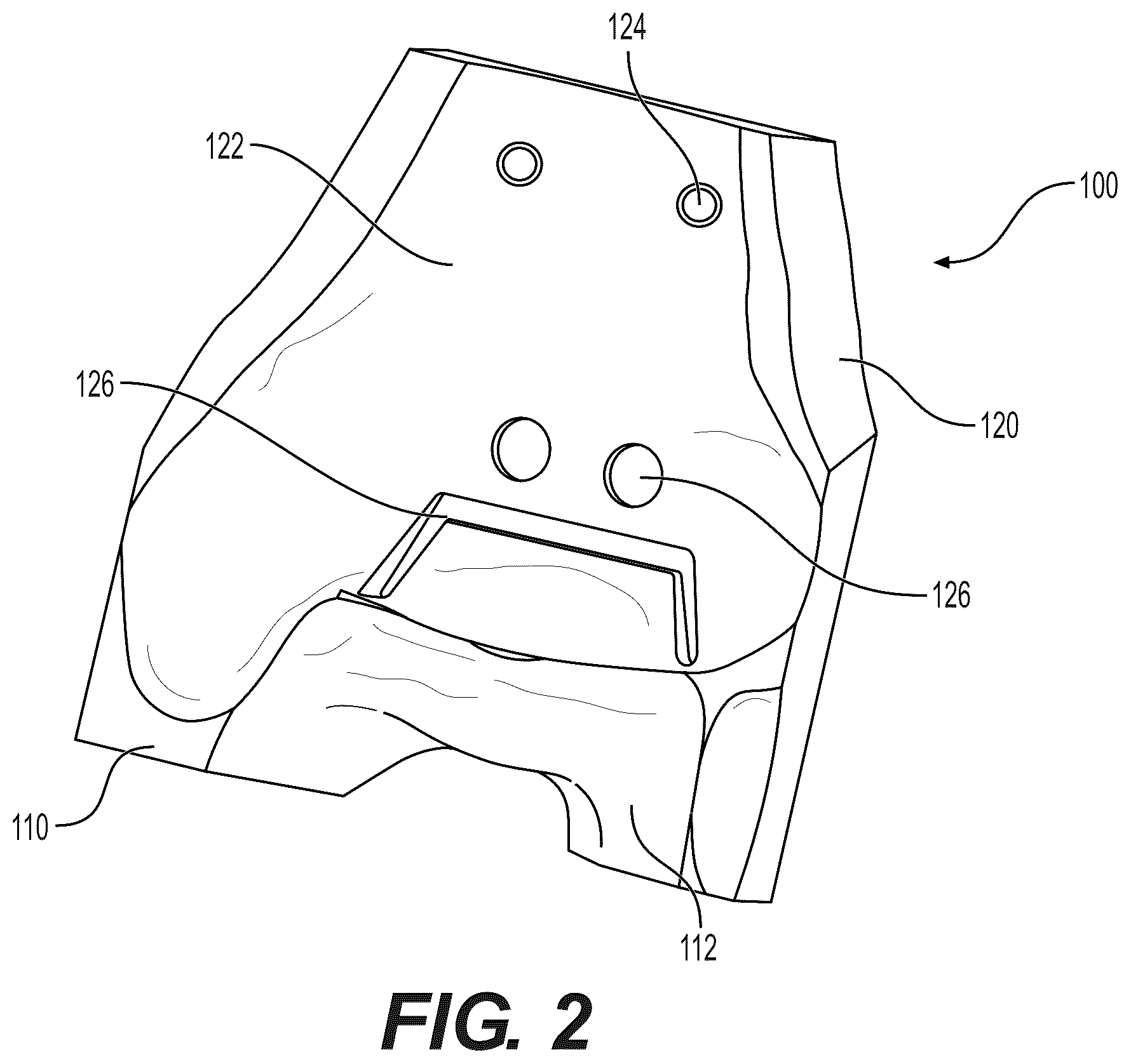Patent US12310604 Figure 2 – Patient-specific template for total ankle replacement
