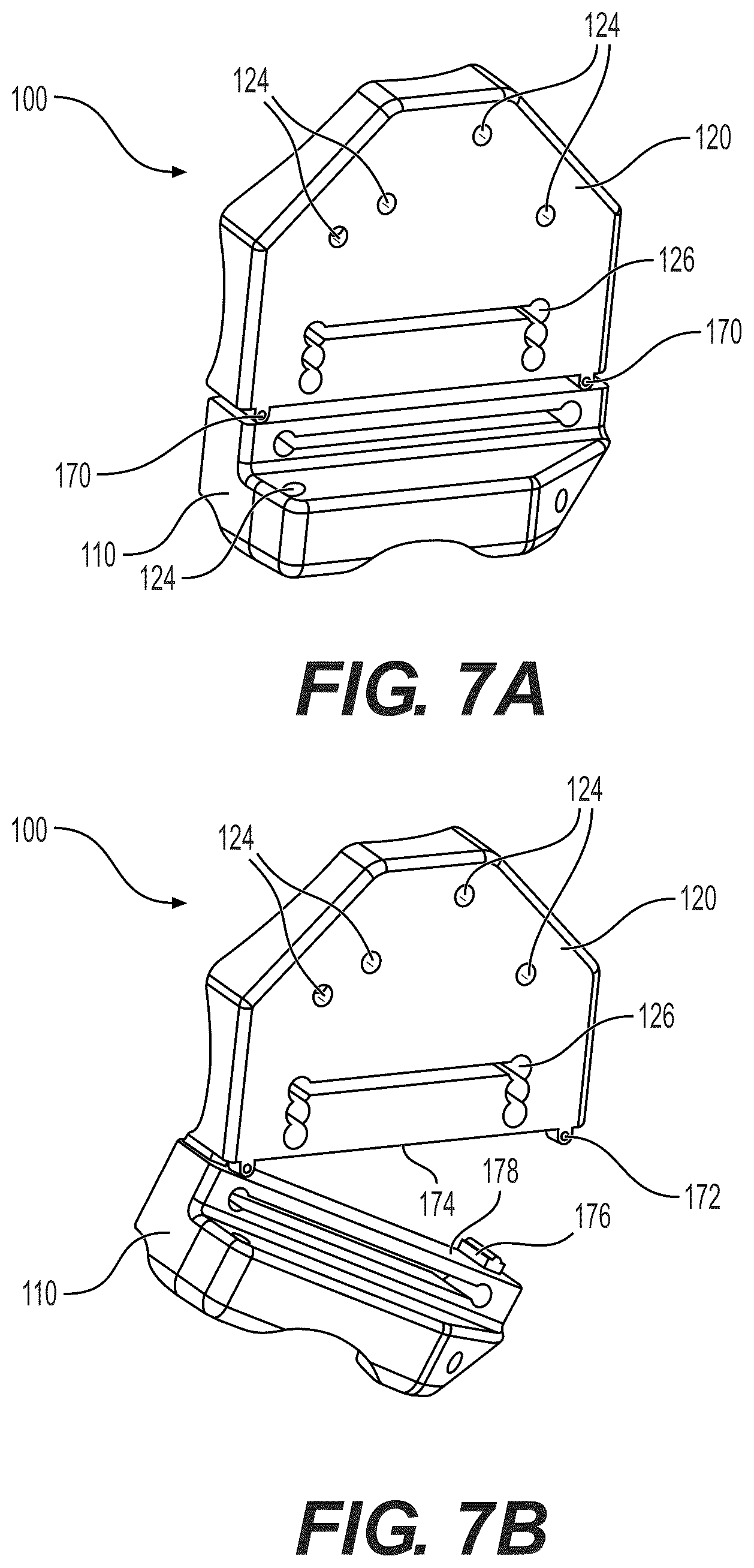 Patent US12310604 Figure 7 – Patient-specific template for total ankle replacement