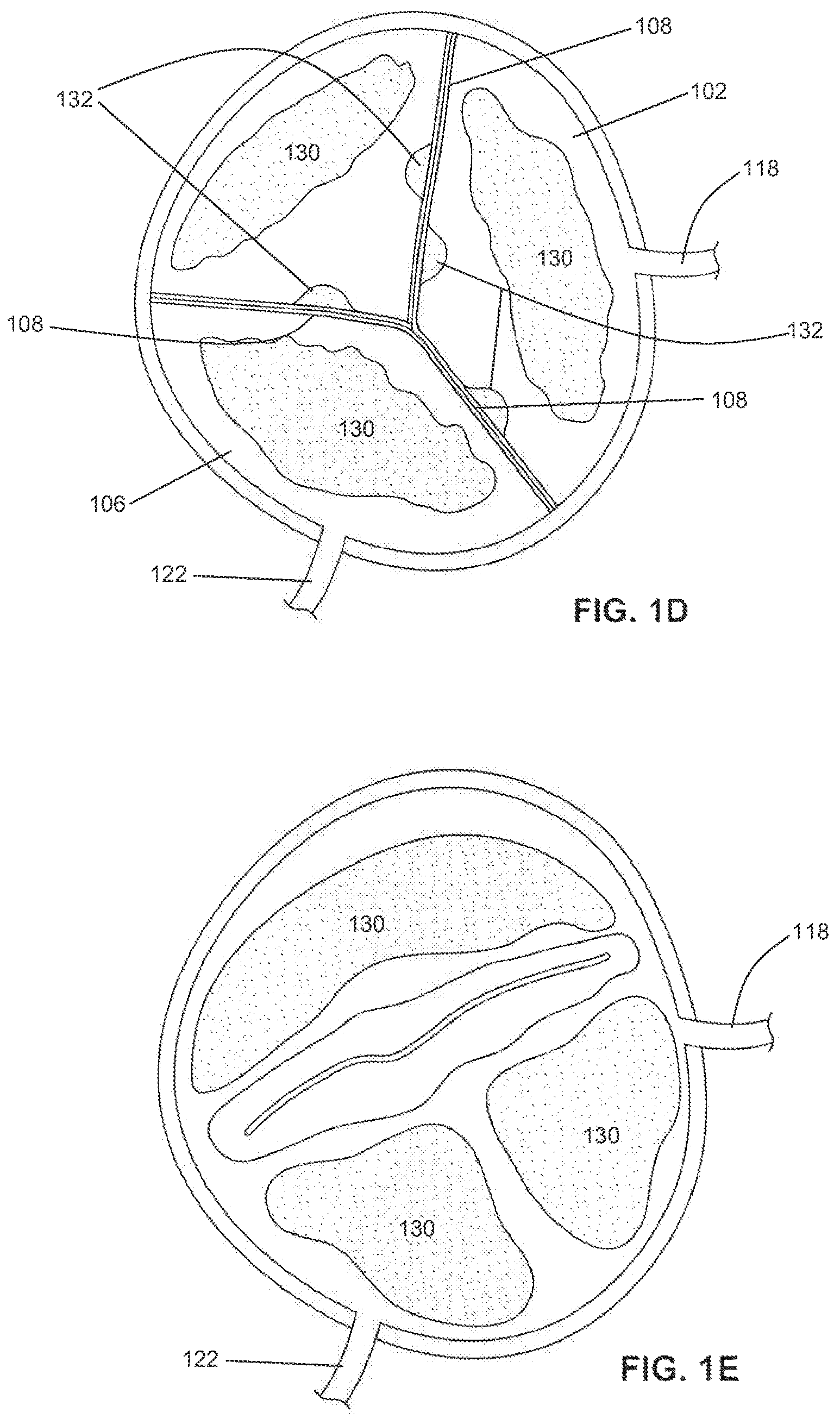 Patent US12310605 Figure 3 – Shock wave valvuloplasty with multiple balloons