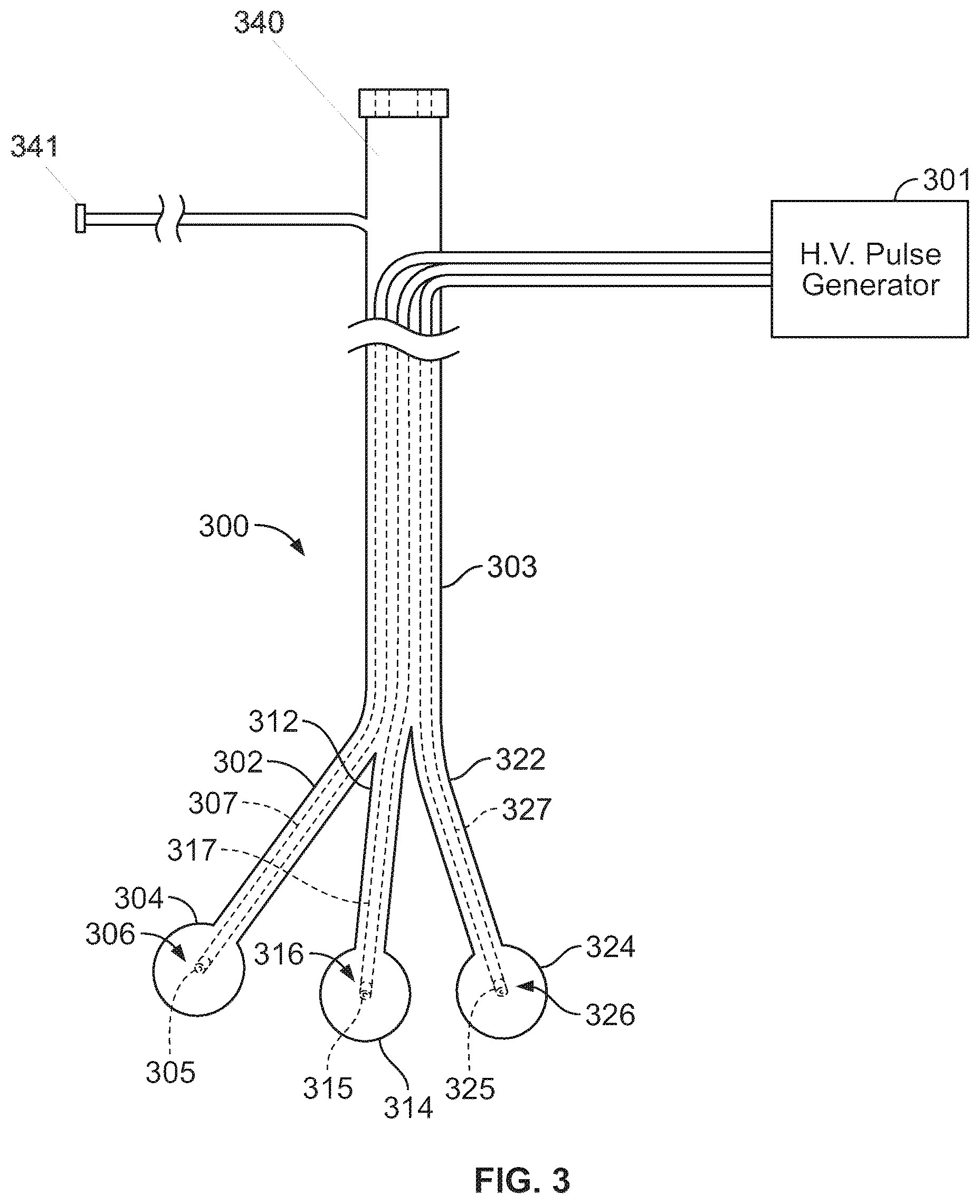 Patent US12310605 Figure 6 – Shock wave valvuloplasty with multiple balloons