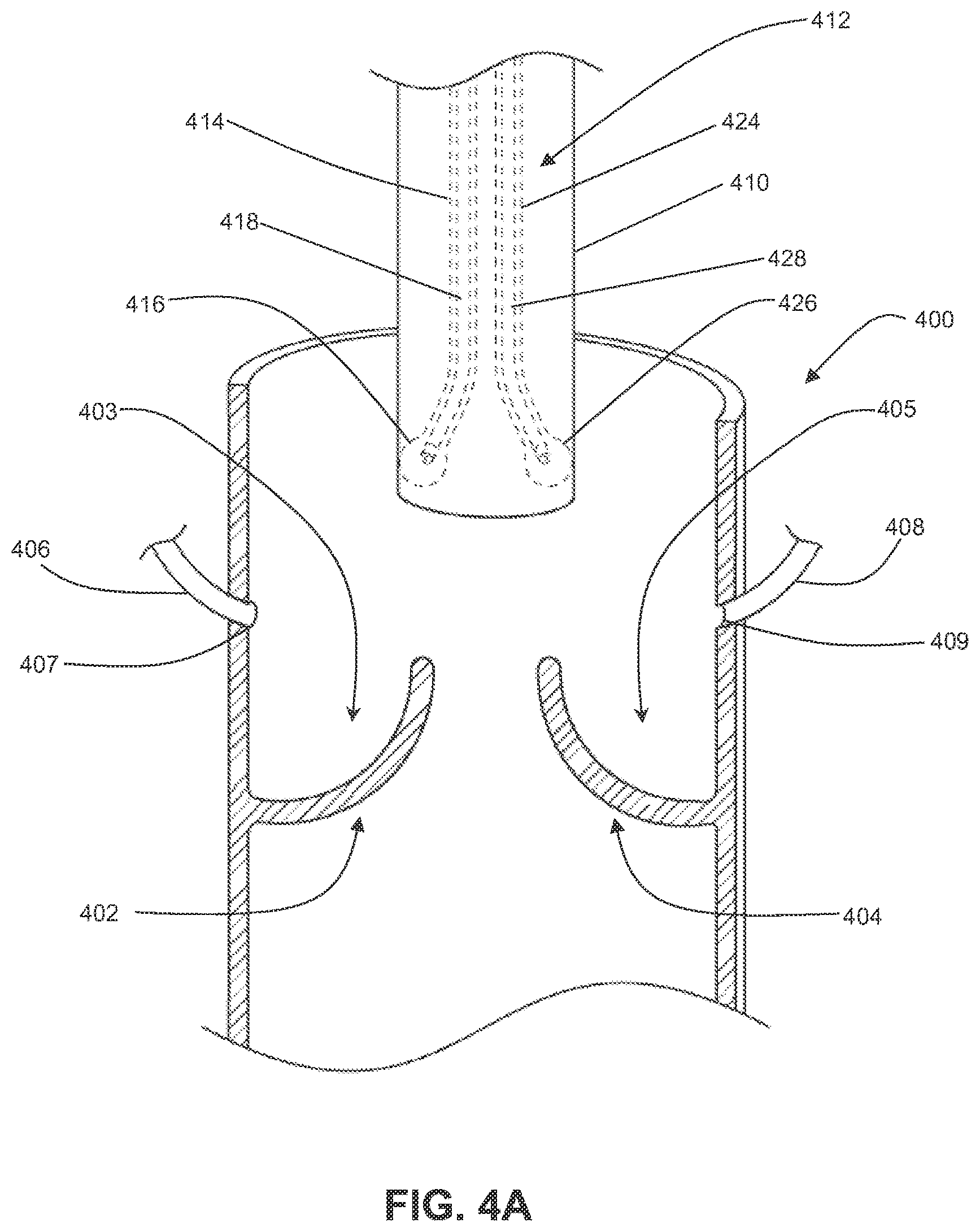 Patent US12310605 Figure 7 – Shock wave valvuloplasty with multiple balloons