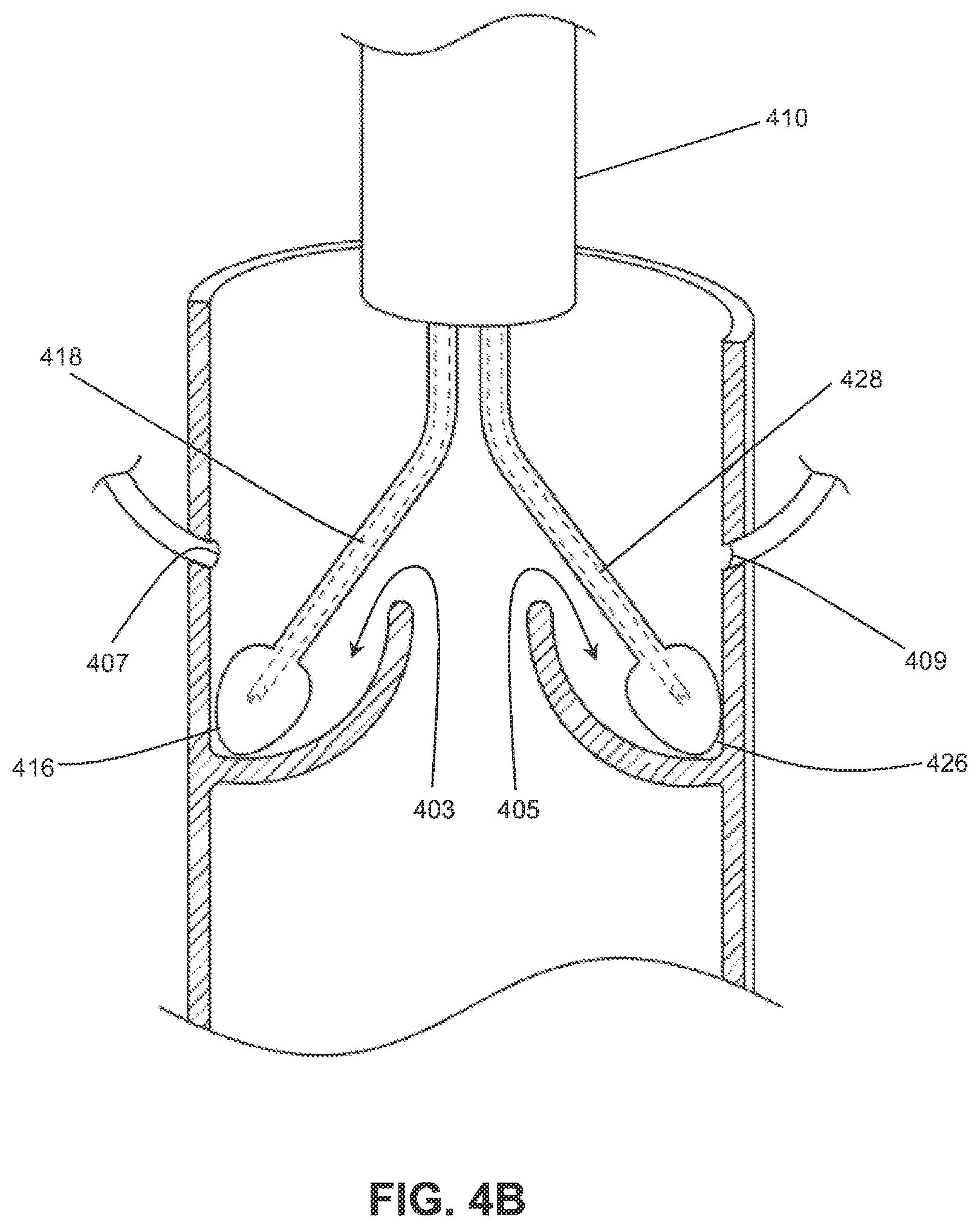 Patent US12310605 Figure 8 – Shock wave valvuloplasty with multiple balloons