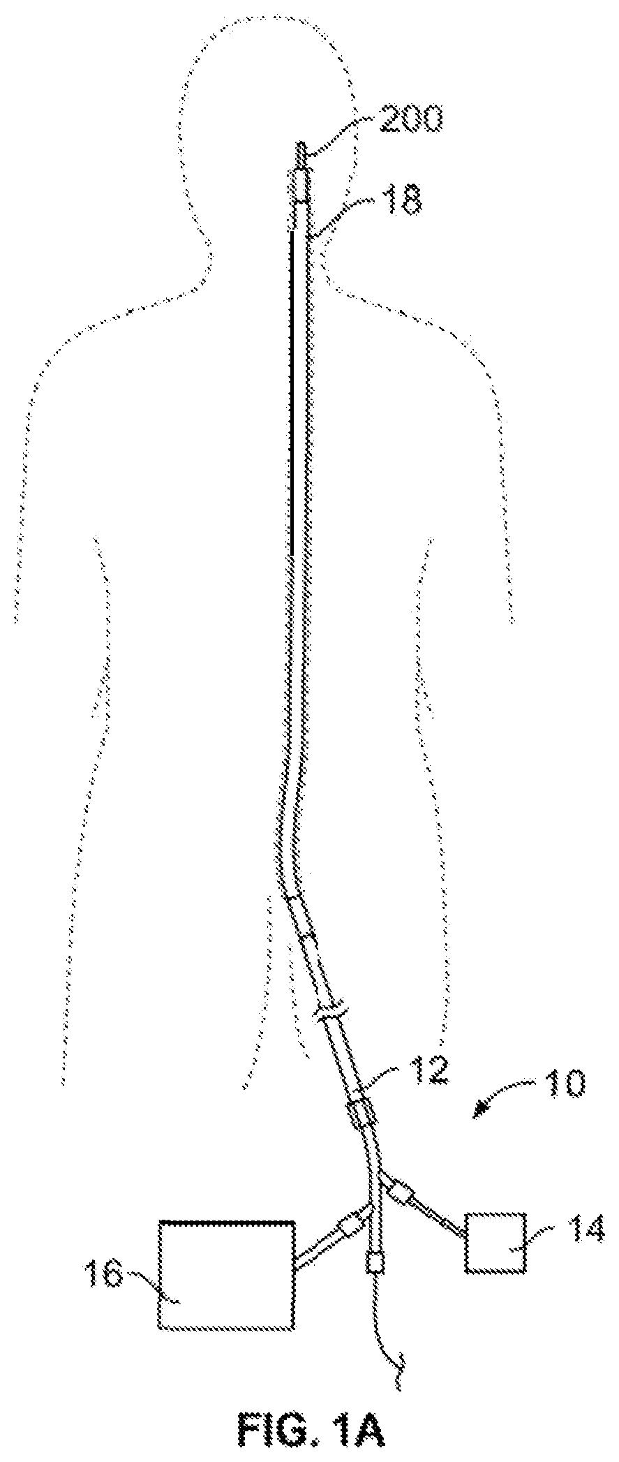 Patent US12310607 Figure 1 – Retrieval systems and methods for use thereof