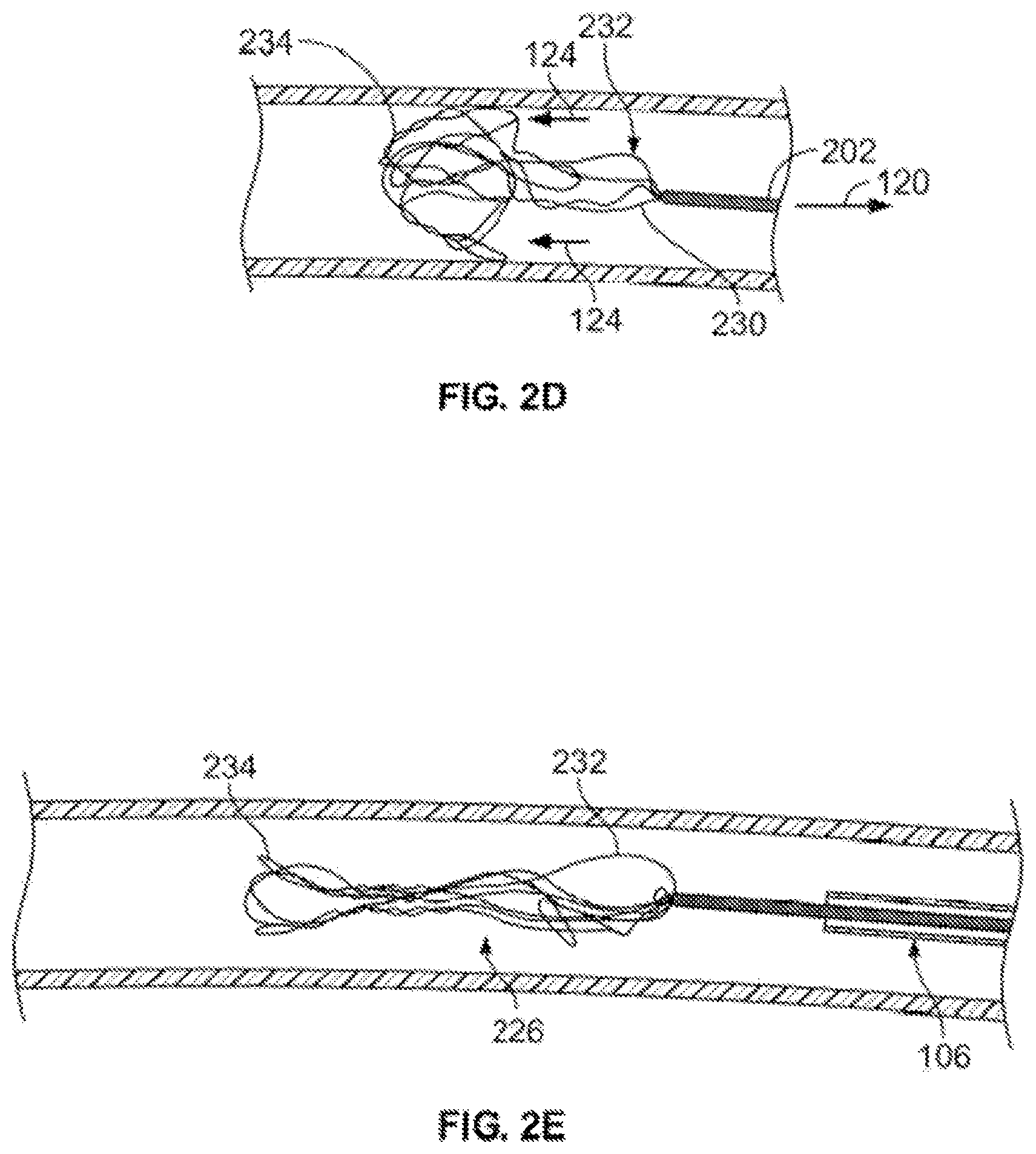 Patent US12310607 Figure 4 – Retrieval systems and methods for use thereof