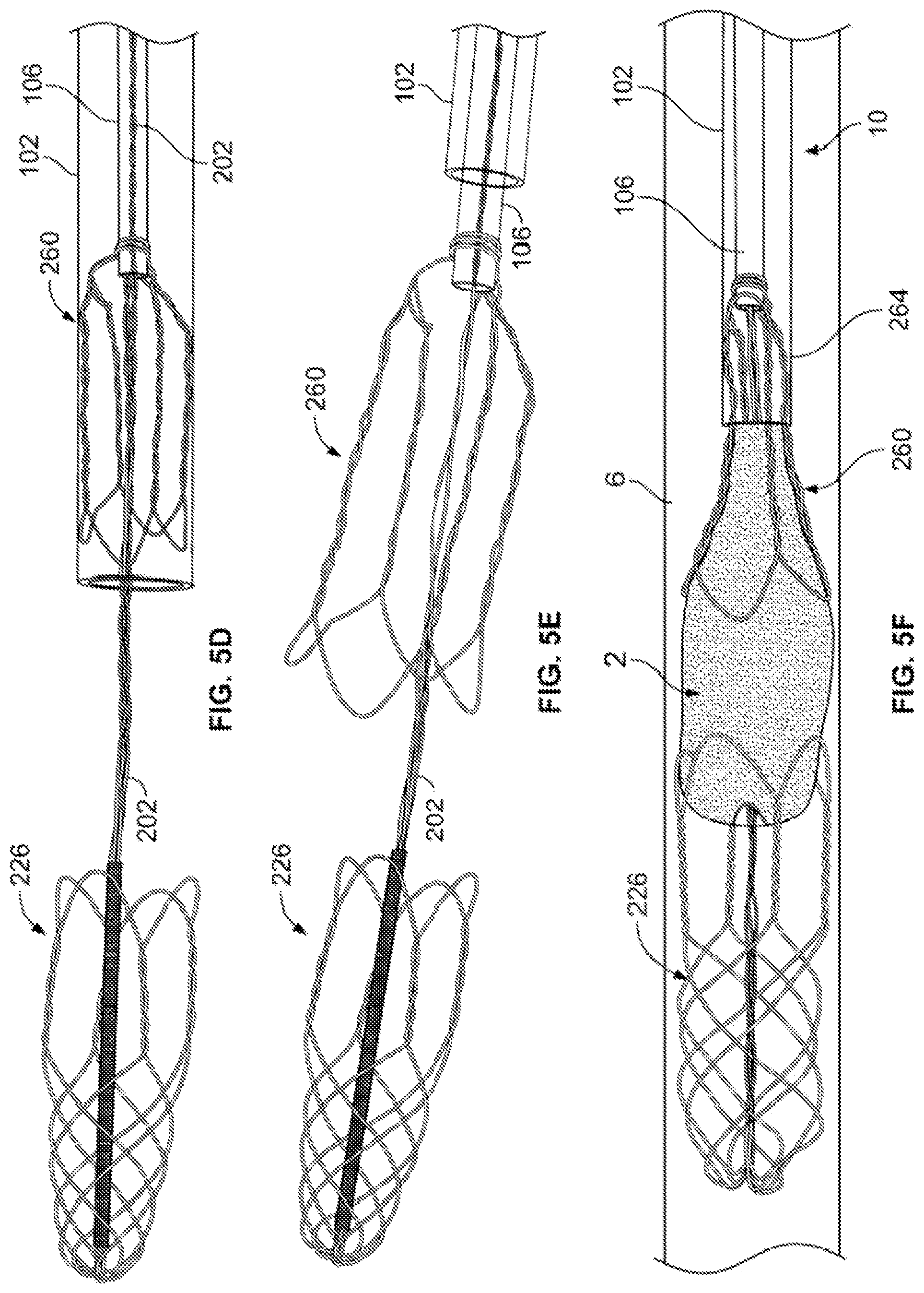 Patent US12310607 Figure 12 – Retrieval systems and methods for use thereof
