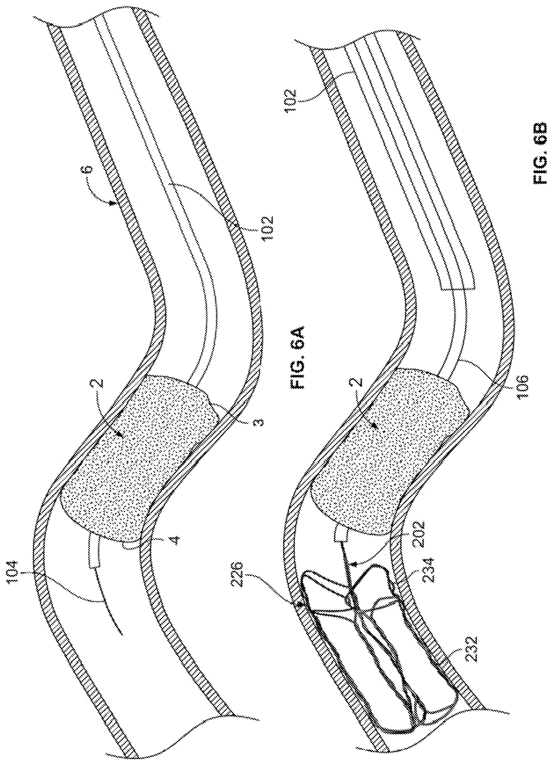 Patent US12310607 Figure 13 – Retrieval systems and methods for use thereof
