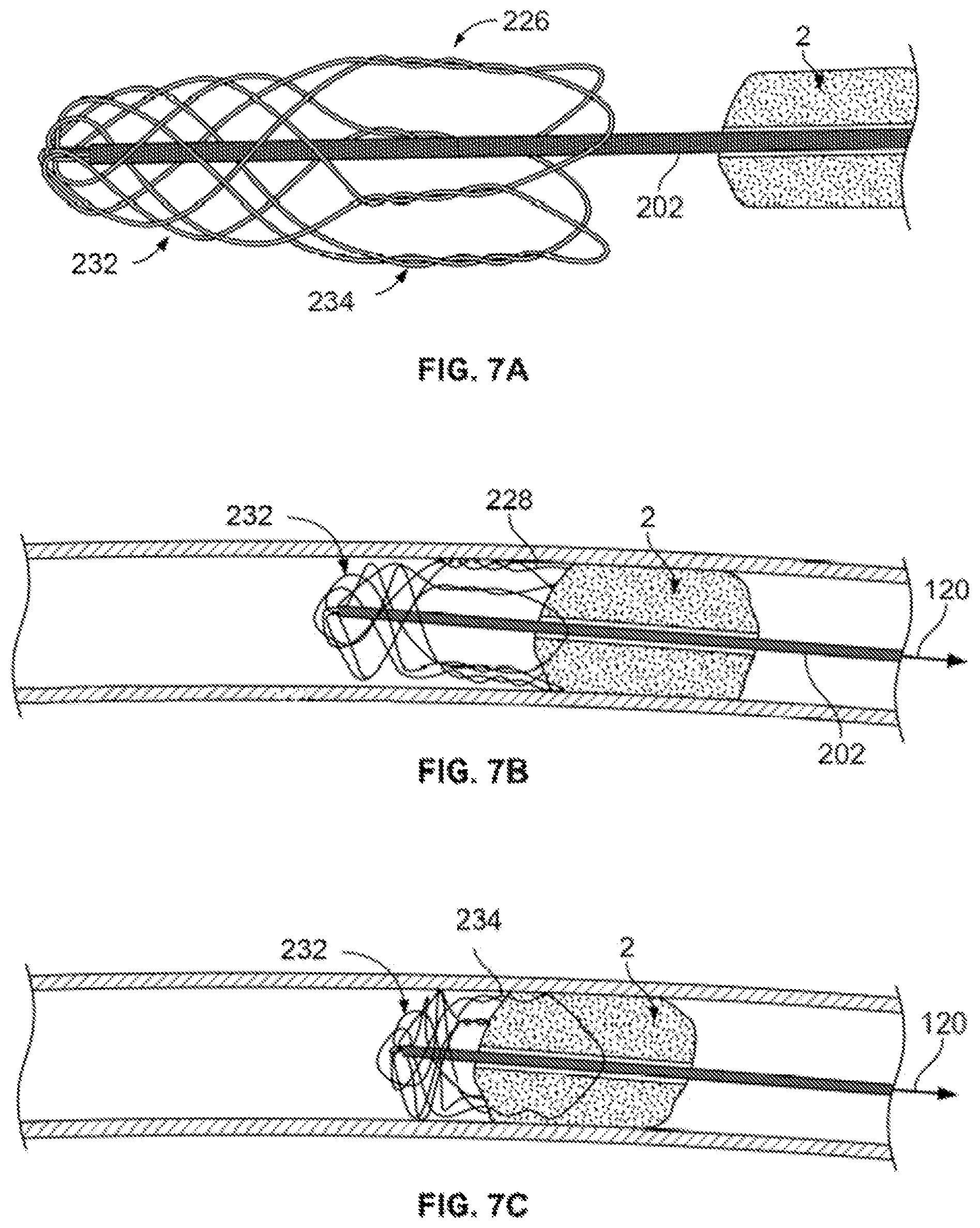 Patent US12310607 Figure 14 – Retrieval systems and methods for use thereof