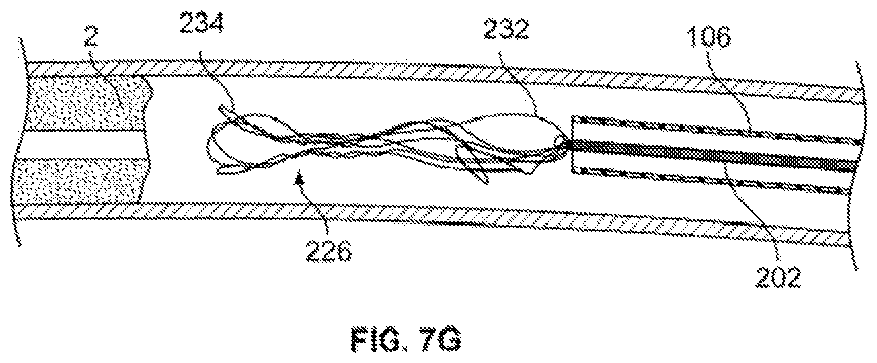 Patent US12310607 Figure 16 – Retrieval systems and methods for use thereof