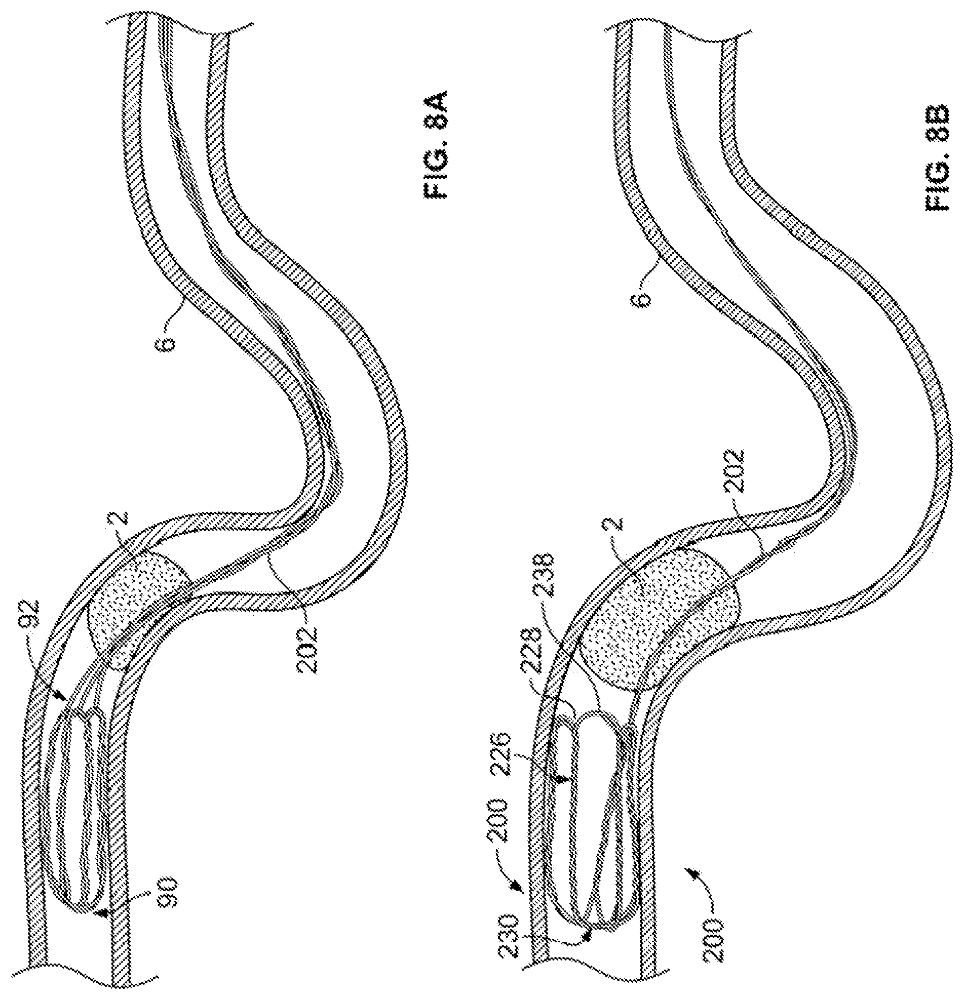 Patent US12310607 Figure 17 – Retrieval systems and methods for use thereof