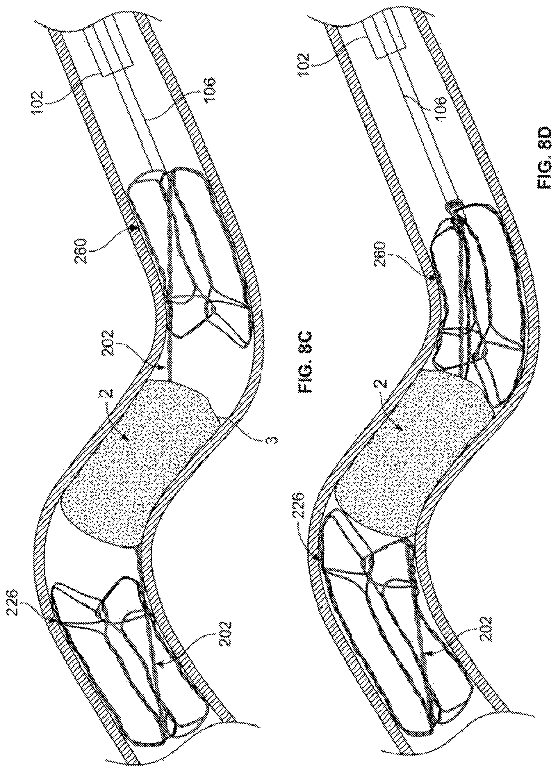Patent US12310607 Figure 18 – Retrieval systems and methods for use thereof
