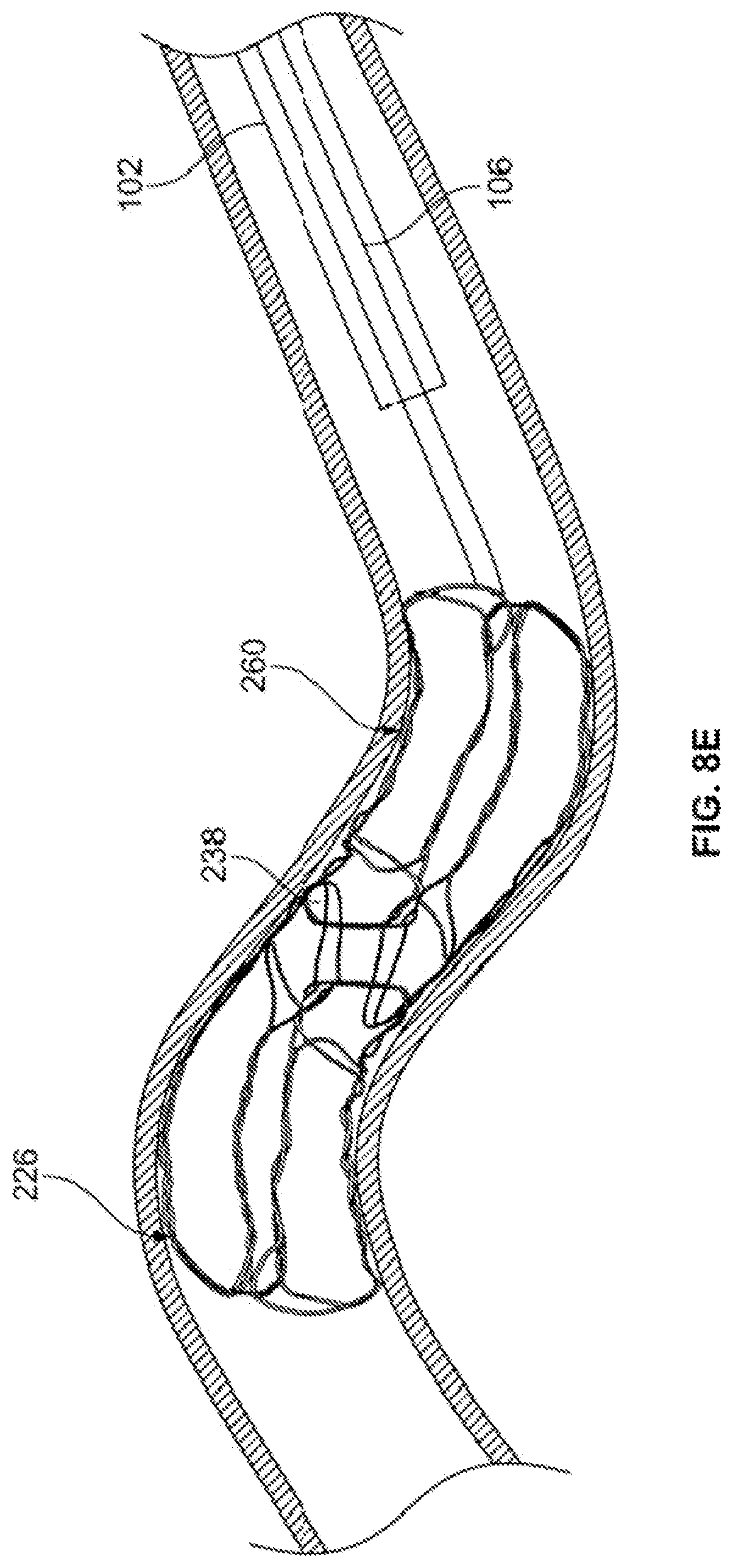 Patent US12310607 Figure 19 – Retrieval systems and methods for use thereof
