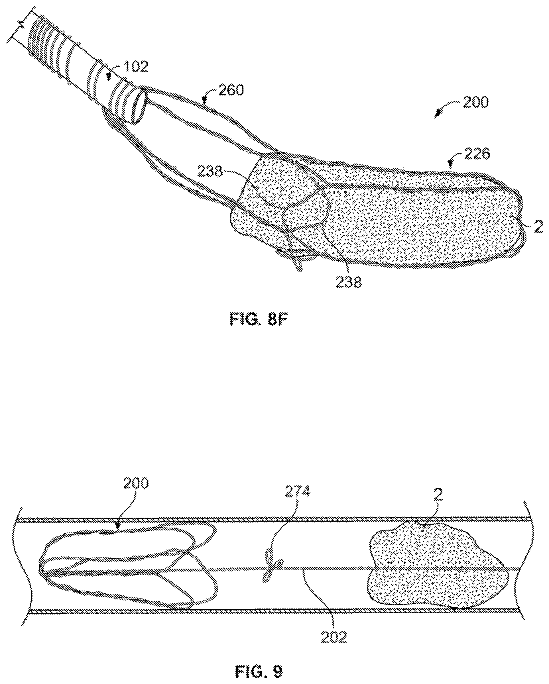 Patent US12310607 Figure 20 – Retrieval systems and methods for use thereof
