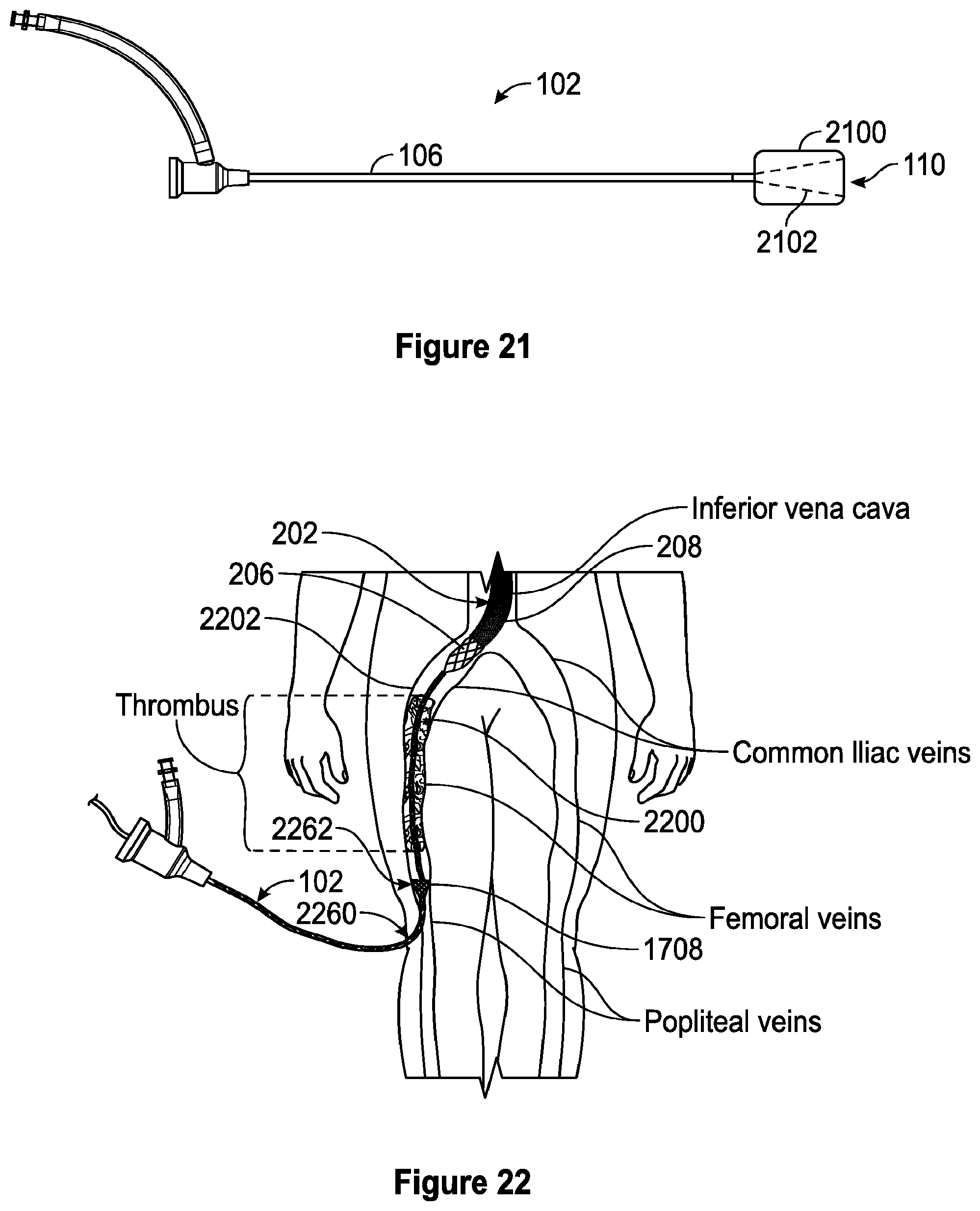 Patent US12310608 Figure 12 – Intravascular treatment of vascular occlusion and associated devices, systems, and methods