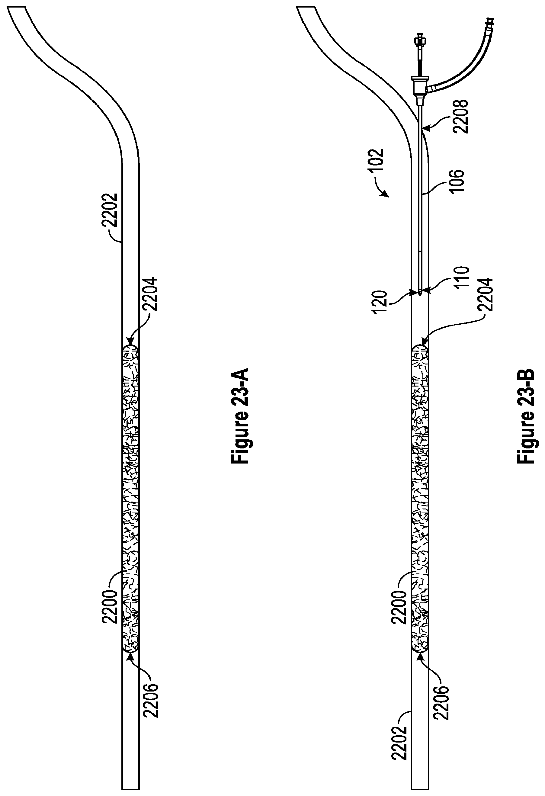 Patent US12310608 Figure 13 – Intravascular treatment of vascular occlusion and associated devices, systems, and methods