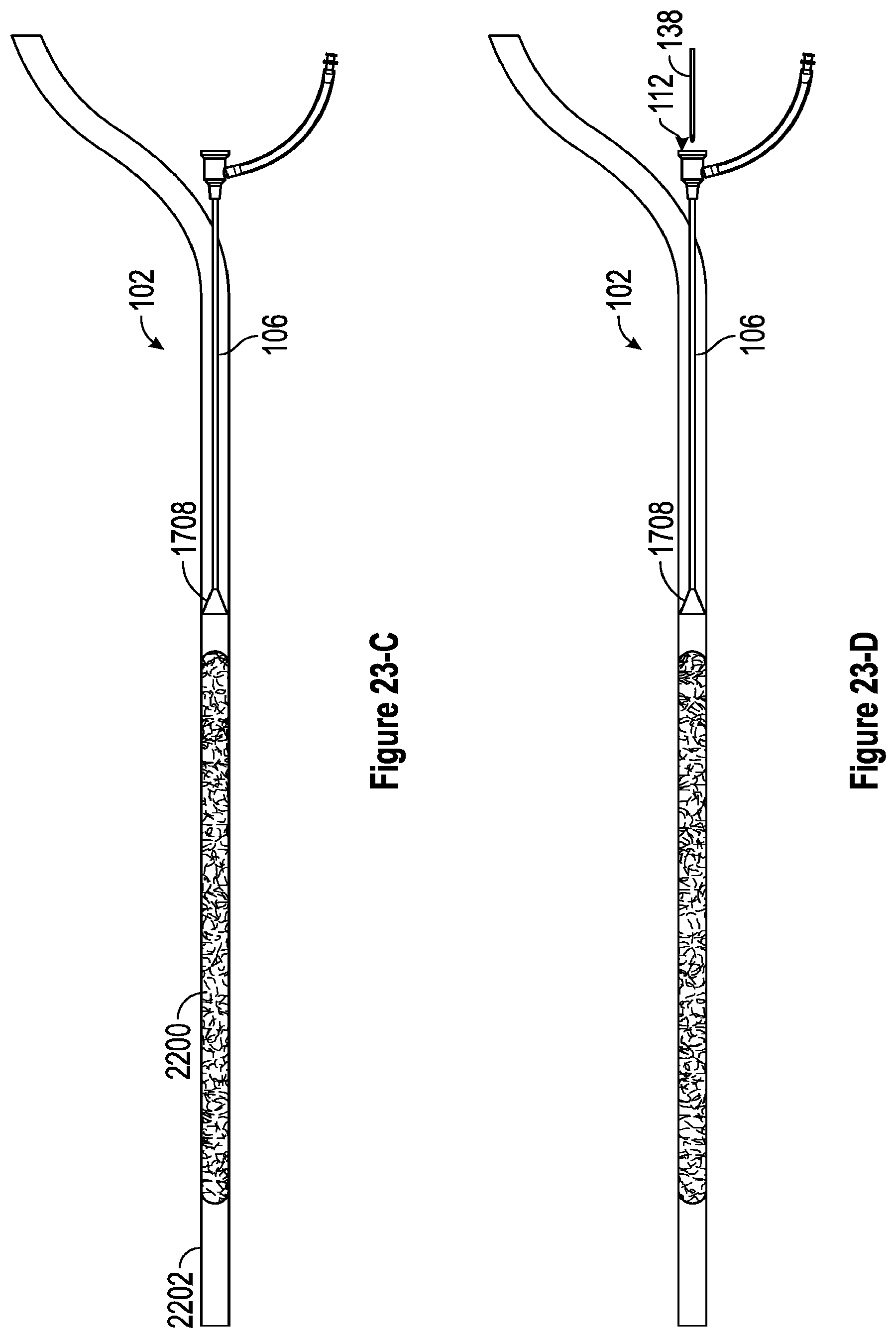 Patent US12310608 Figure 14 – Intravascular treatment of vascular occlusion and associated devices, systems, and methods