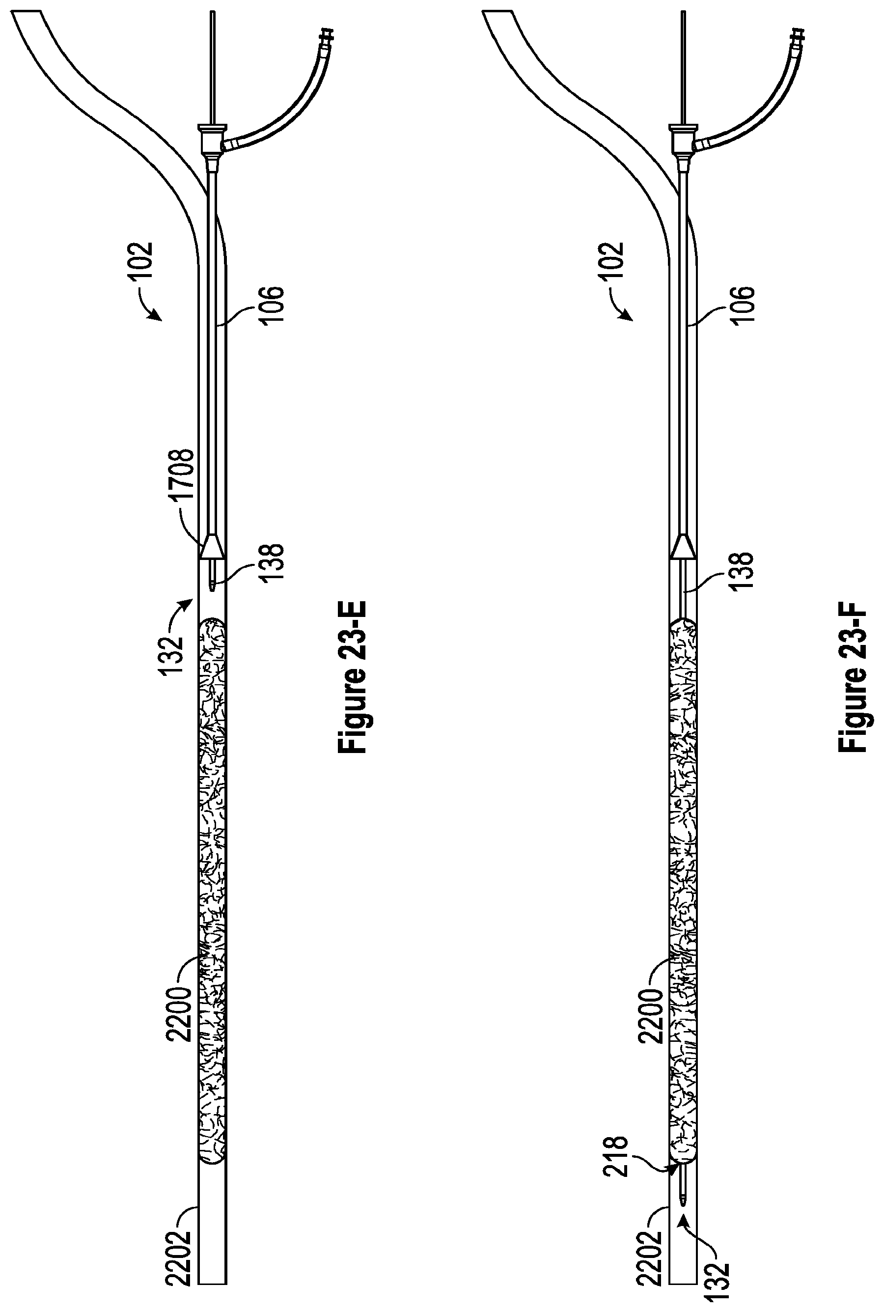 Patent US12310608 Figure 15 – Intravascular treatment of vascular occlusion and associated devices, systems, and methods
