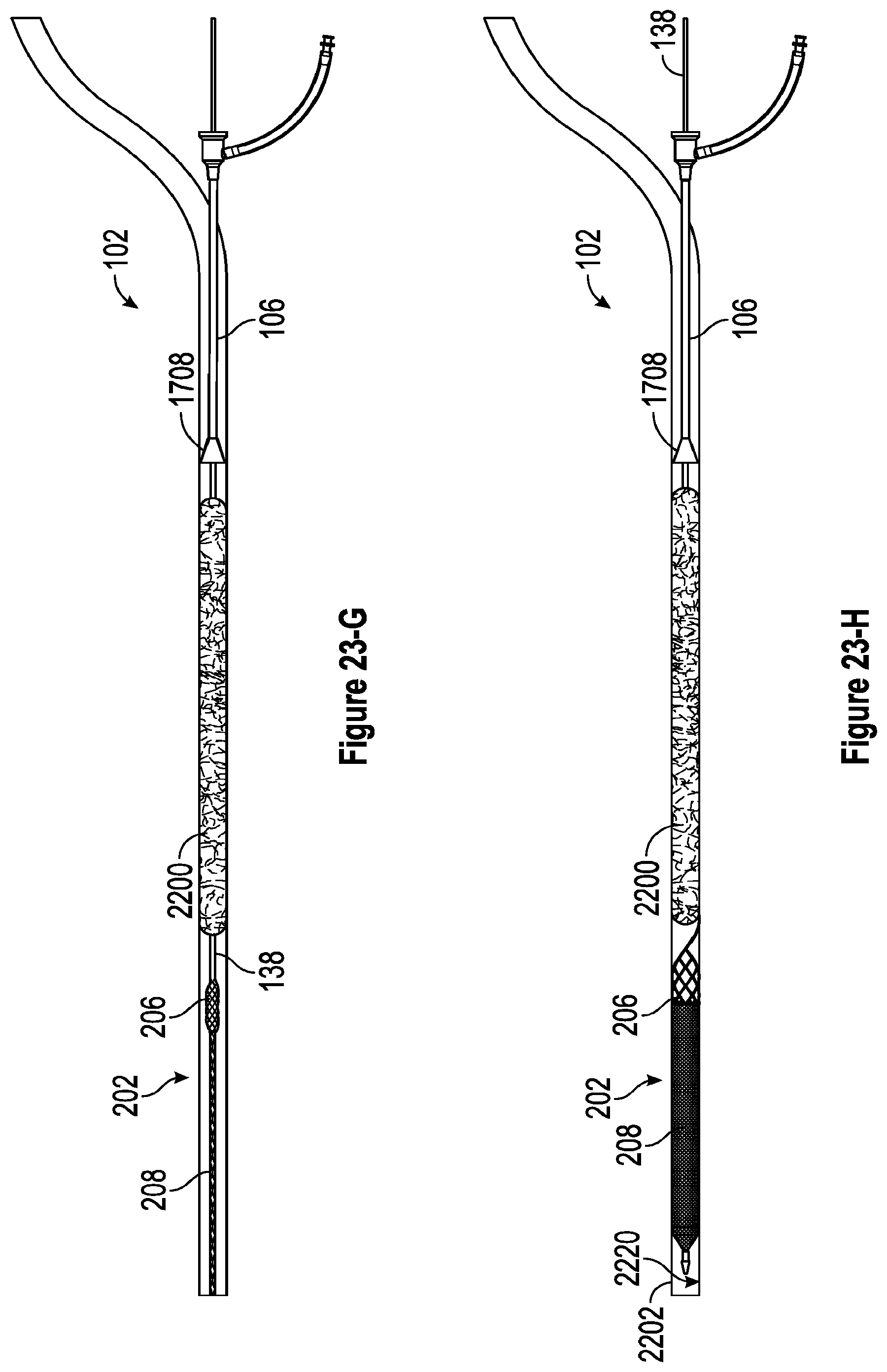 Patent US12310608 Figure 16 – Intravascular treatment of vascular occlusion and associated devices, systems, and methods