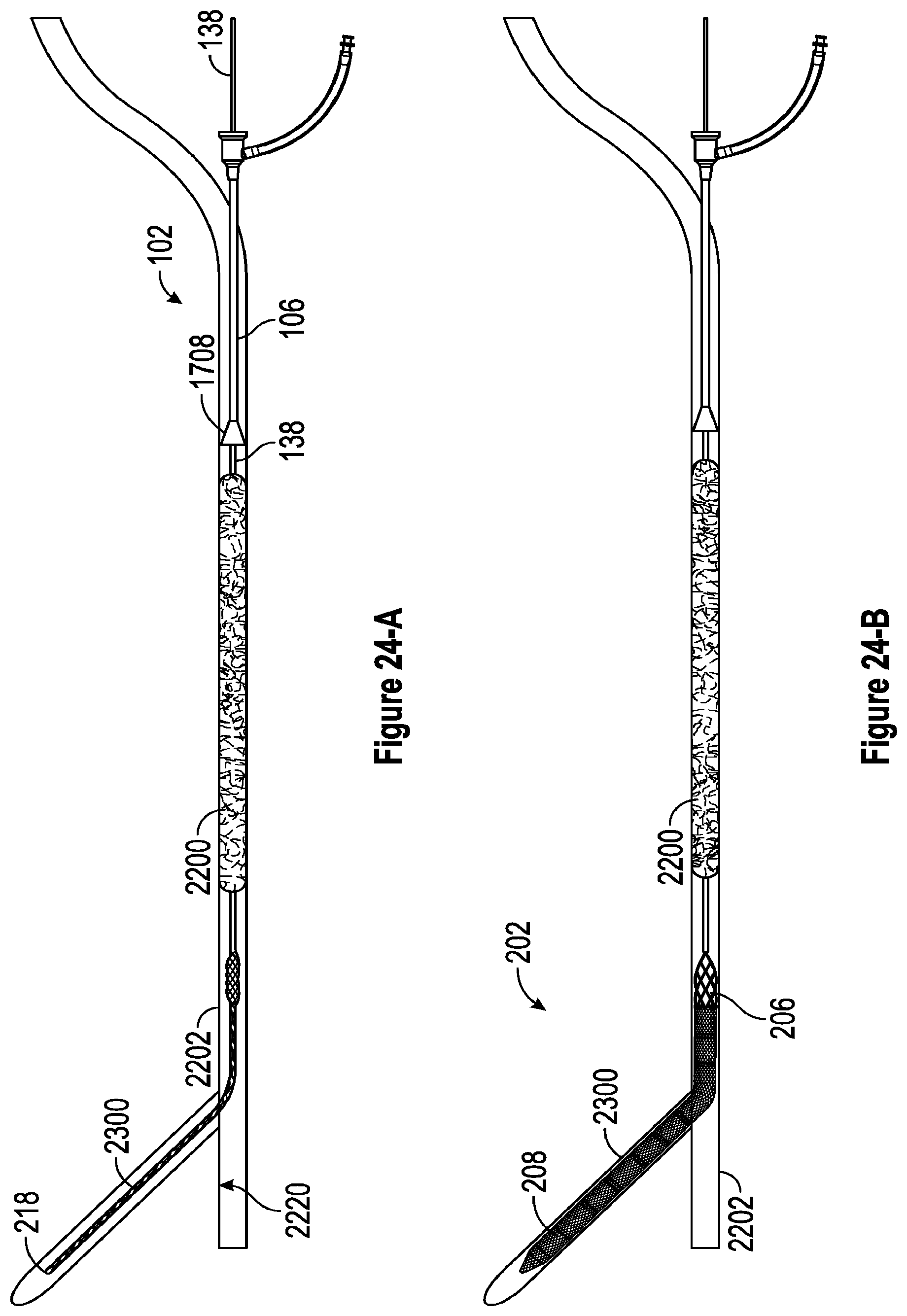 Patent US12310608 Figure 17 – Intravascular treatment of vascular occlusion and associated devices, systems, and methods