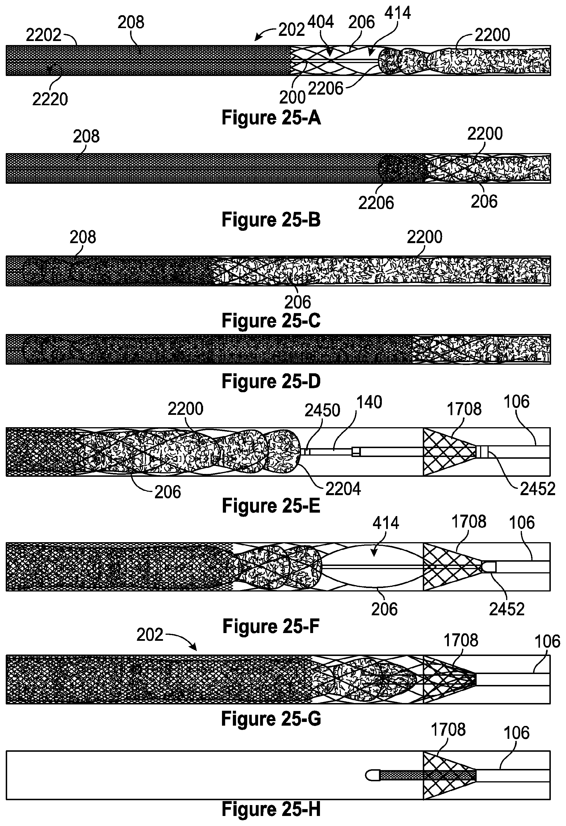 Patent US12310608 Figure 18 – Intravascular treatment of vascular occlusion and associated devices, systems, and methods