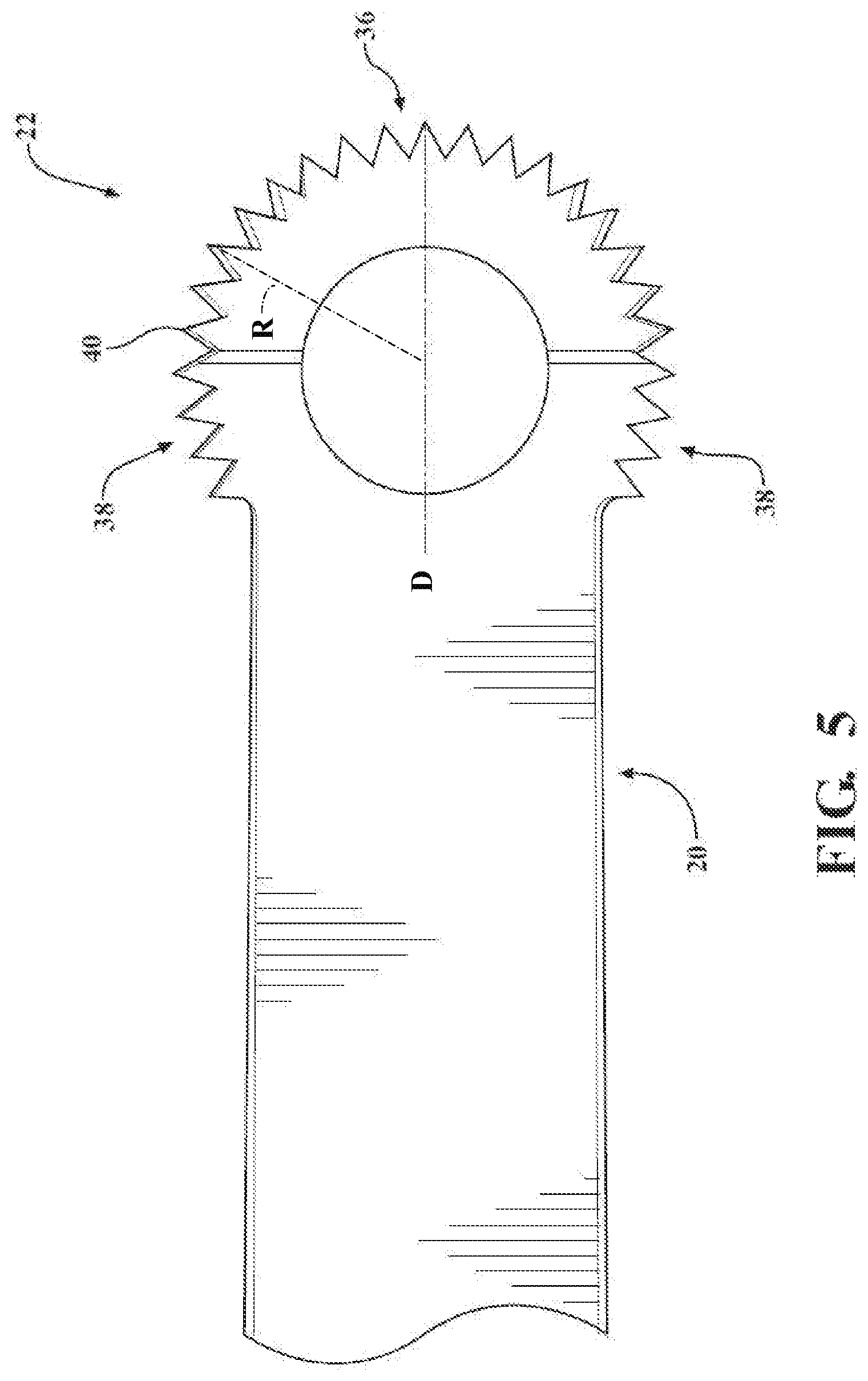 Patent US12310614 Figure 5 – Ultrasonic cutting tip for lumbar procedures