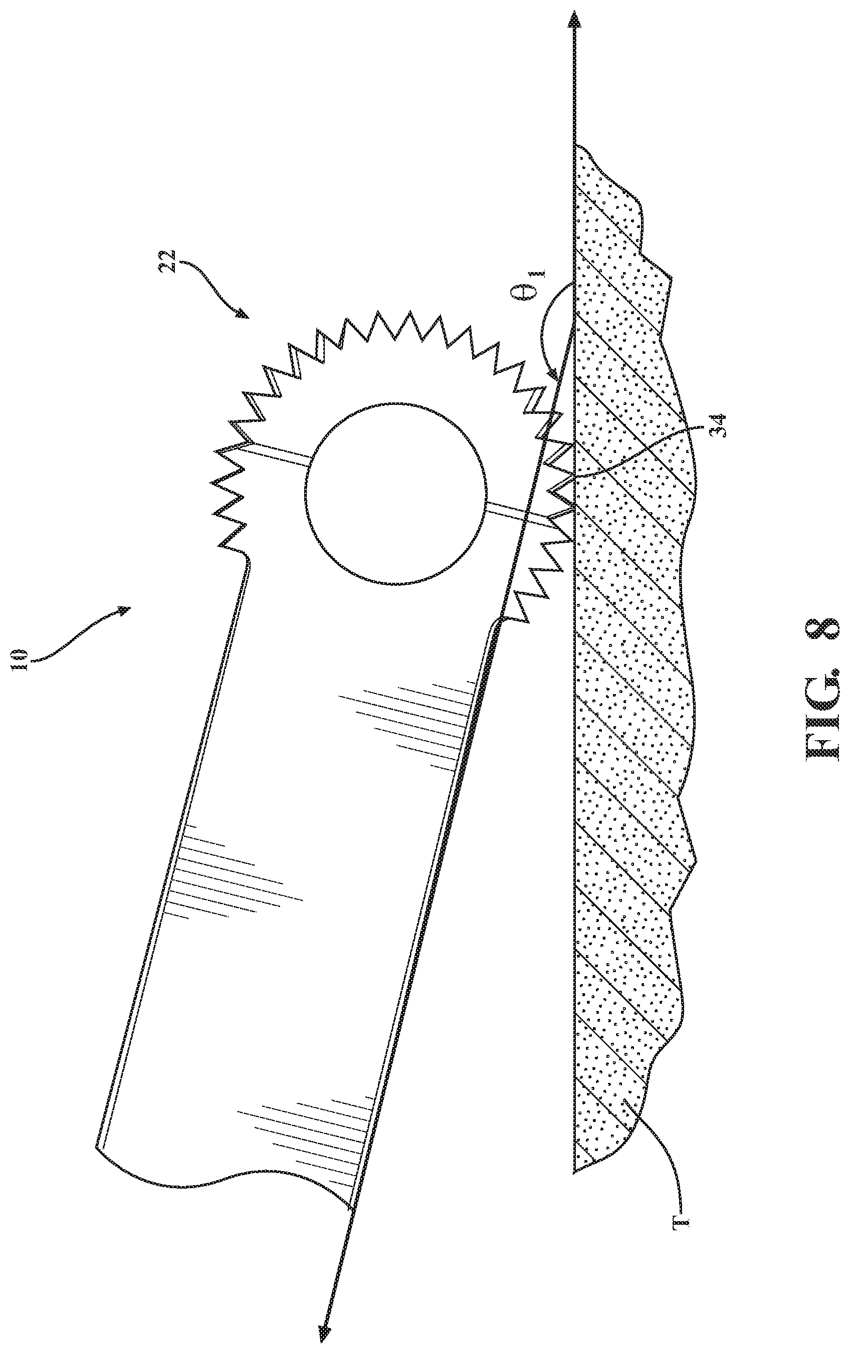 Patent US12310614 Figure 8 – Ultrasonic cutting tip for lumbar procedures