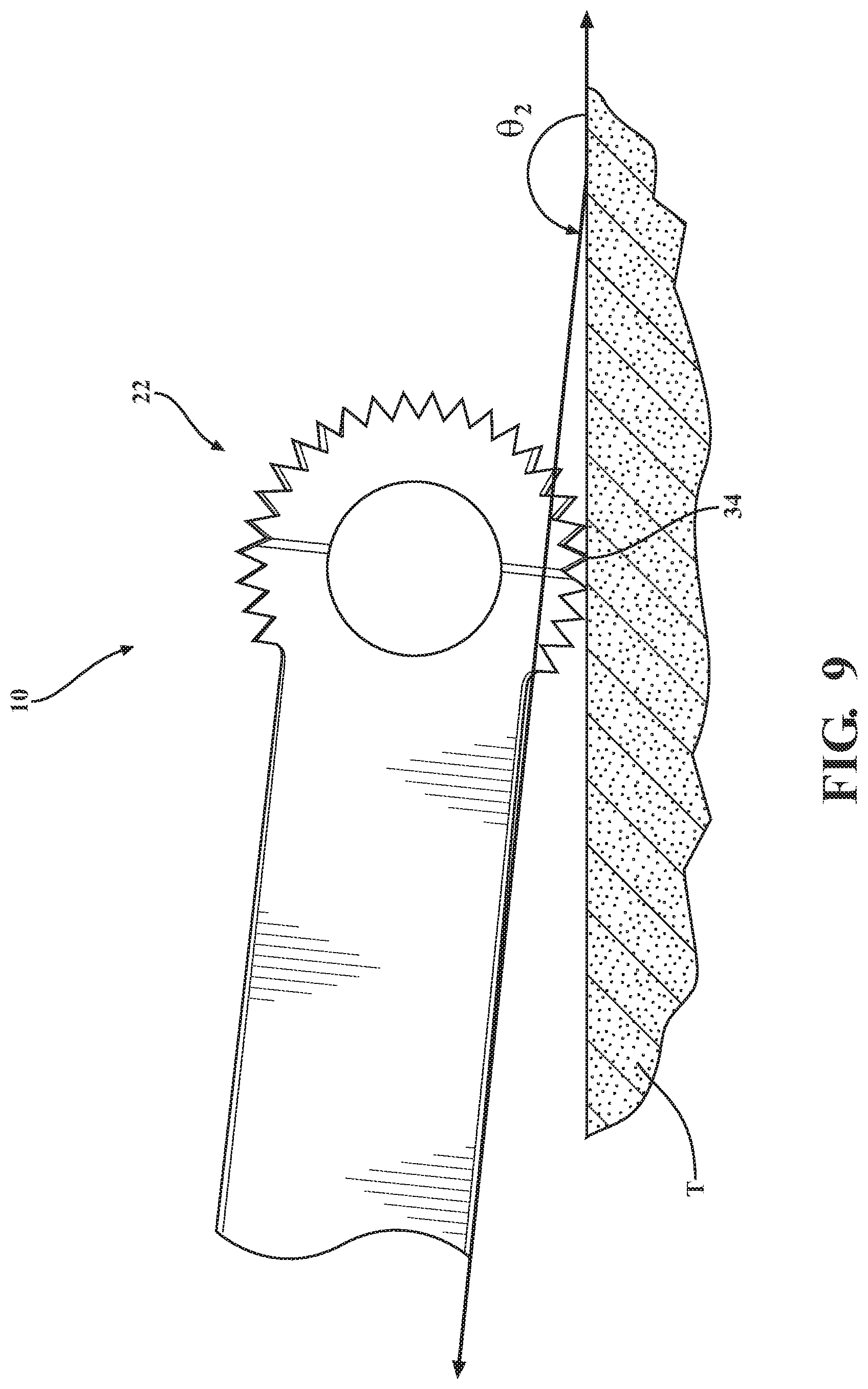 Patent US12310614 Figure 9 – Ultrasonic cutting tip for lumbar procedures